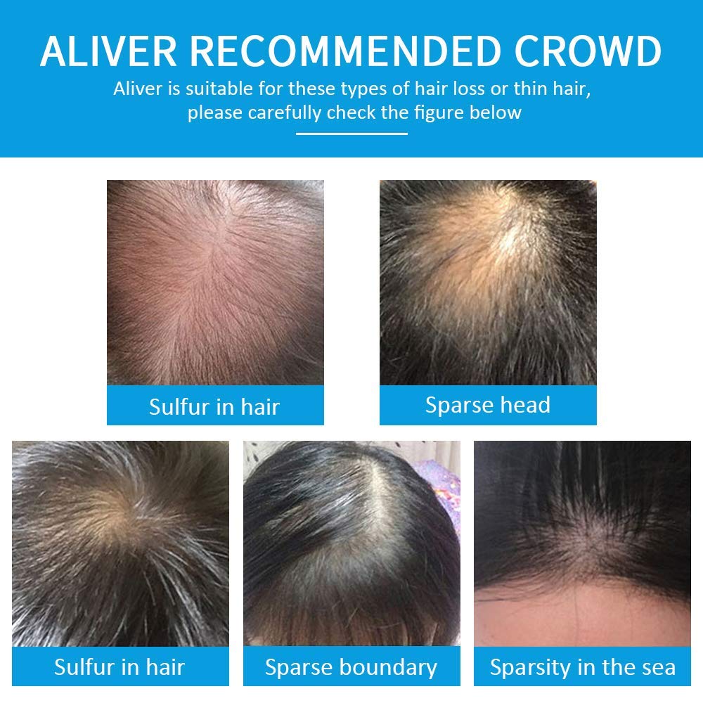 ALIVER Hair Fibers for Thinning Hair – Dark Brown Spray, Undetectable Natural Formula, 15 Seconds to Fuller Hair – Conceals Hair Loss for Men & Women | 0.97 oz