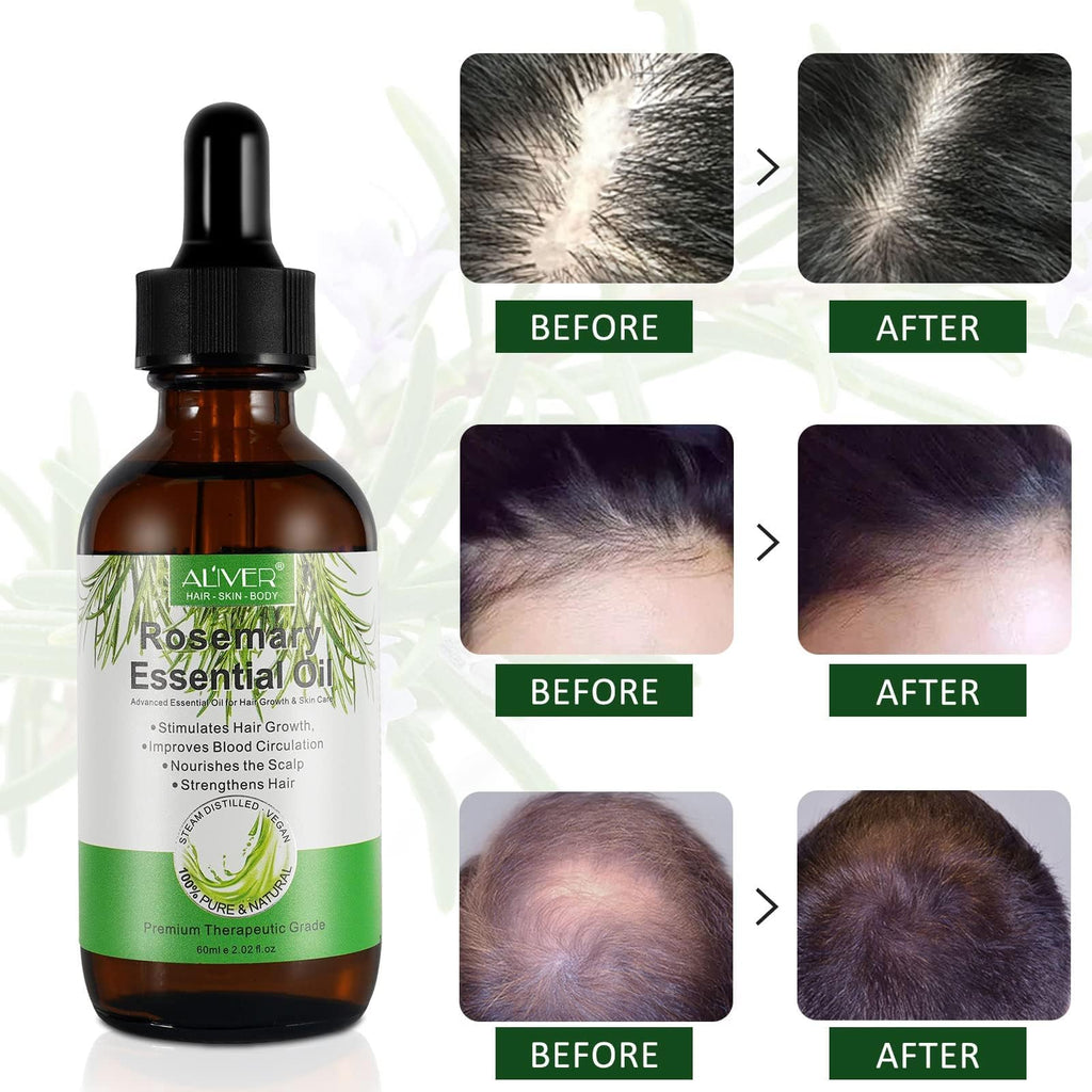 ALIVER Pure Rosemary Essential Oil – 2-Pack for Hair & Scalp Care | 2.02 Fl Oz