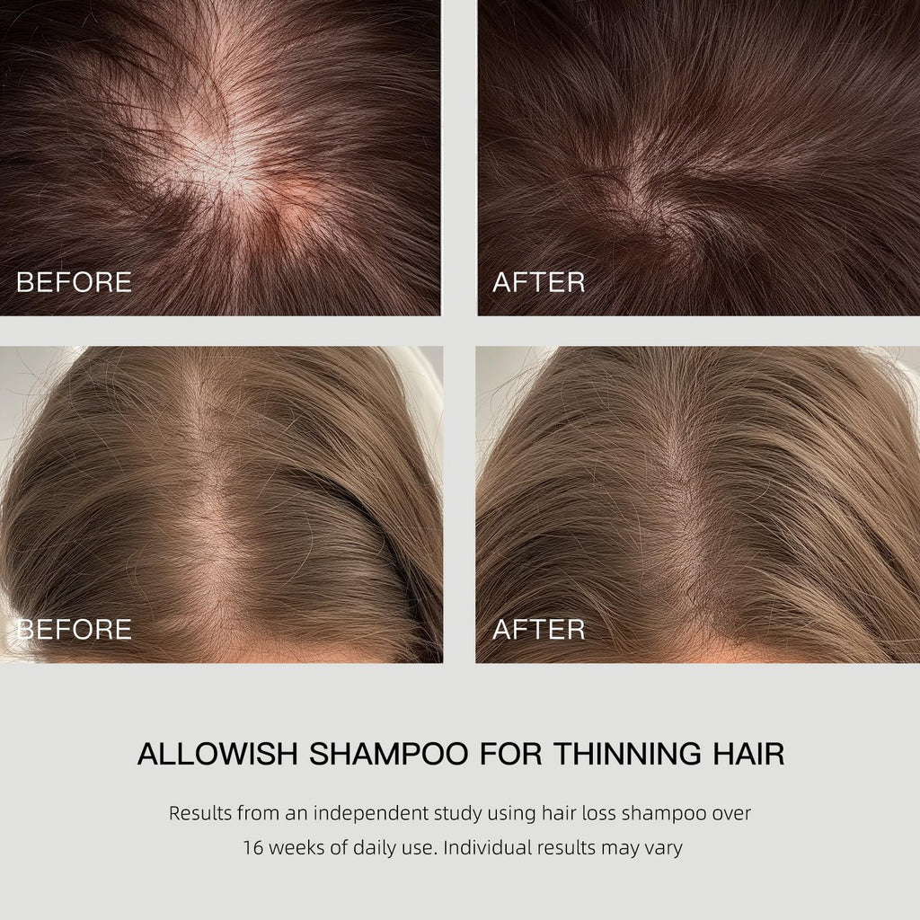 ALLOWISH Hair Loss Shampoo with Biotin, Ginger & Rosemary – Thickening & Hydrating