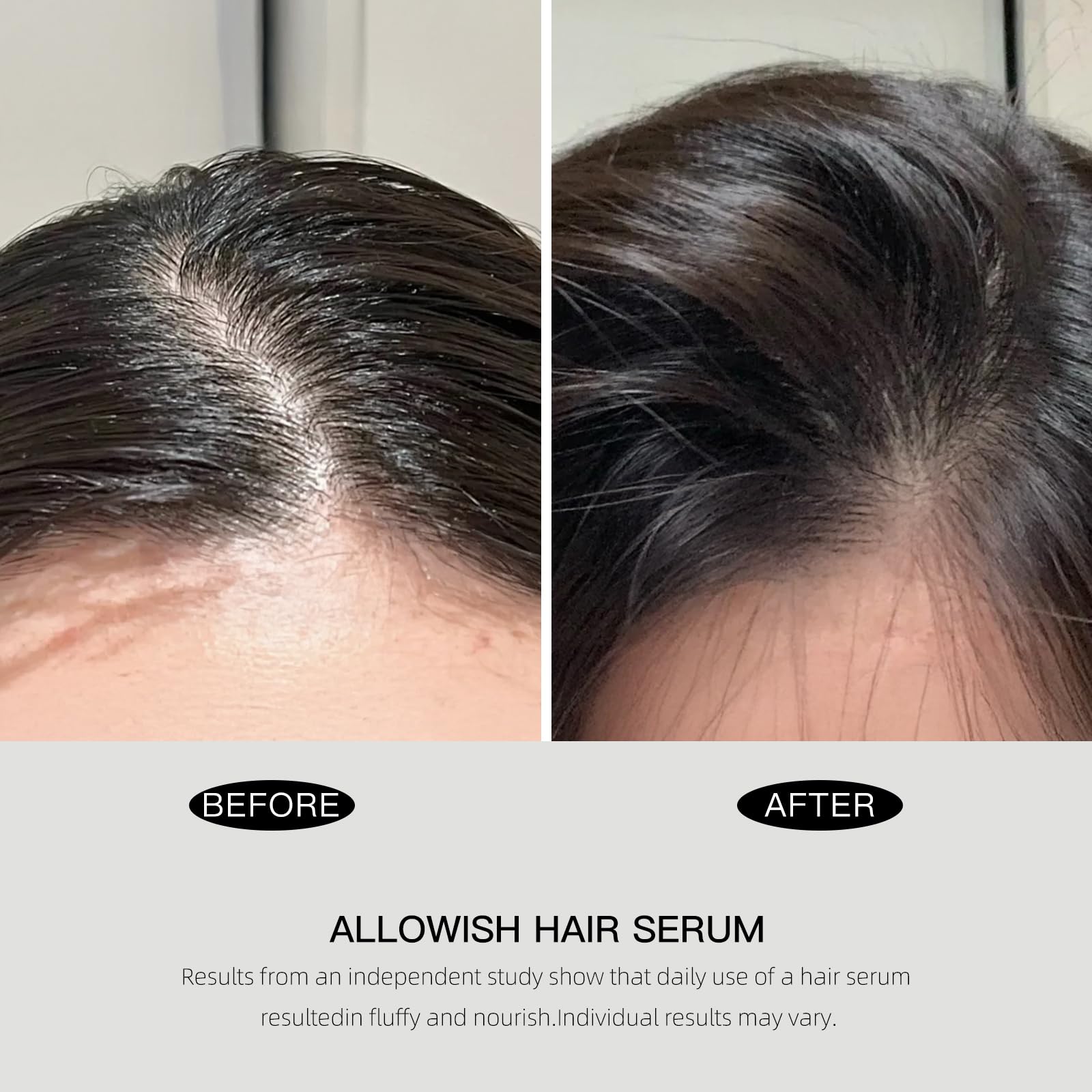 ALLOWISH Advanced Hair Serum - 95 ml Scalp Treatment for Fuller, Glossy Hair | Frizz Control & Healthy Roots