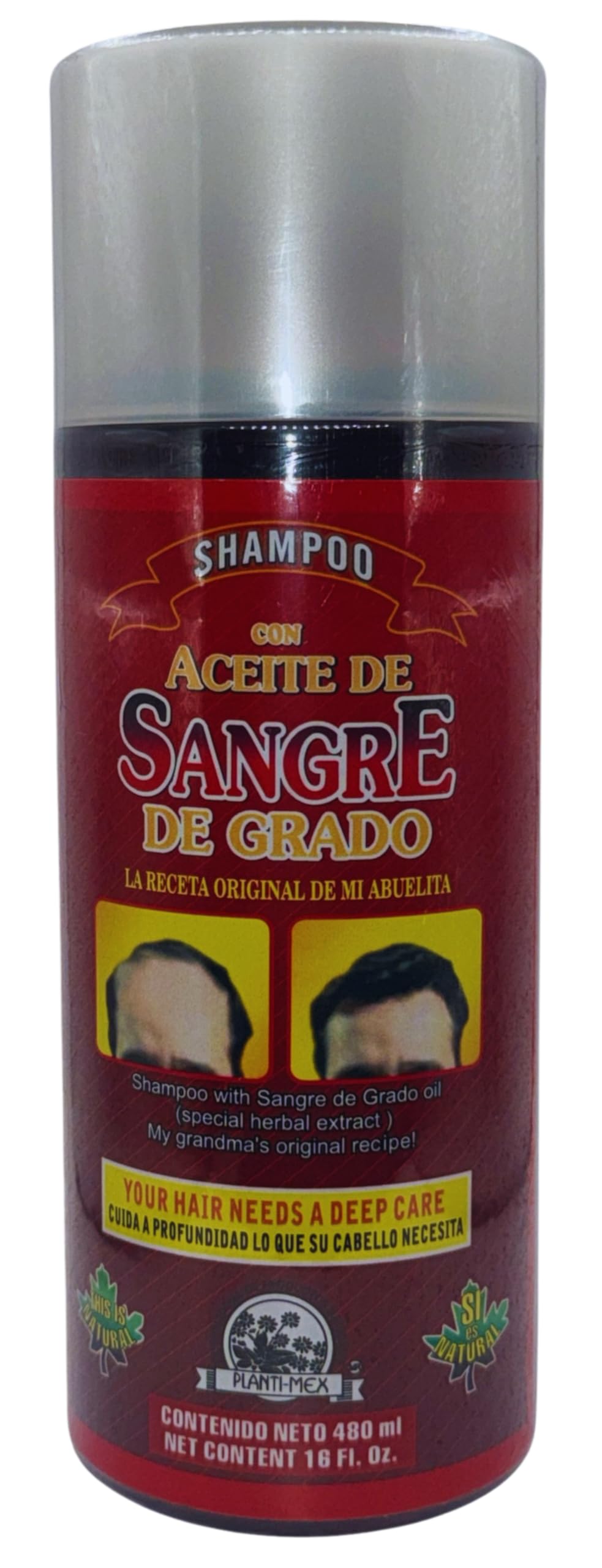 Alma Belleza Dragon's Blood Tree Shampoo Extract - 16 oz with Mamey Seed, Avocado, Jojoba & Vitamin E