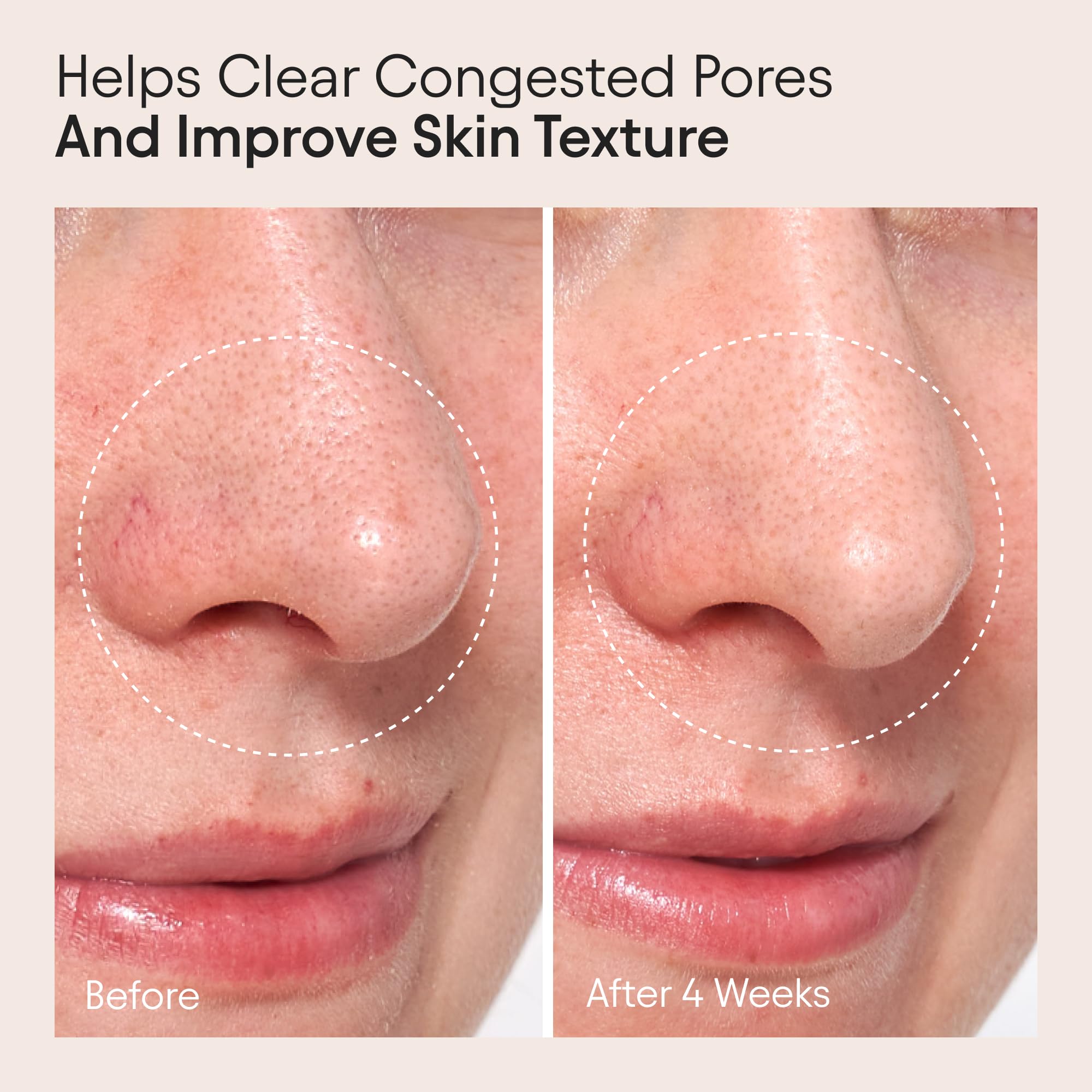 ALPYN Clarifying Facial Oil with Retinol & Pink Algae | Clear Congestion & Glow