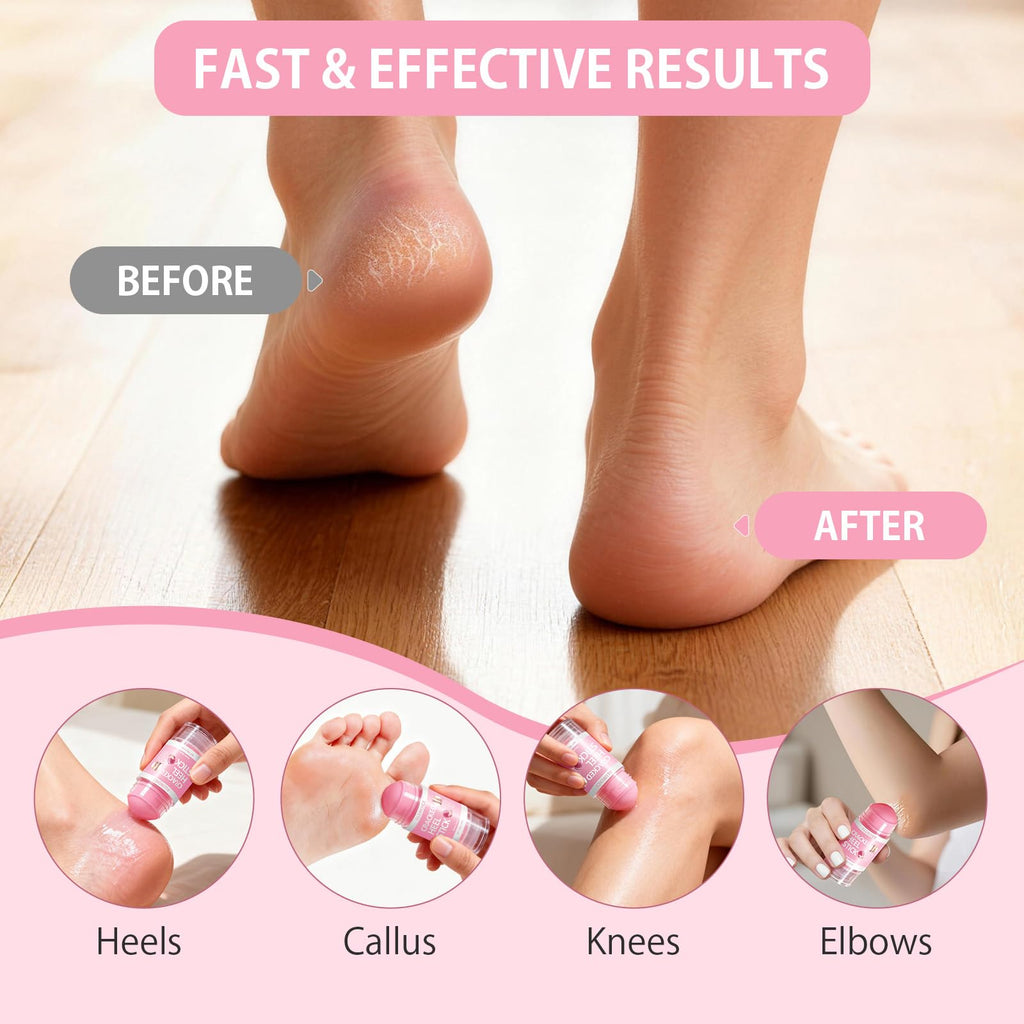 ALUROICE Silicone Moisturizing Socks with Foot Cream – 2-in-1 Dry Feet Care