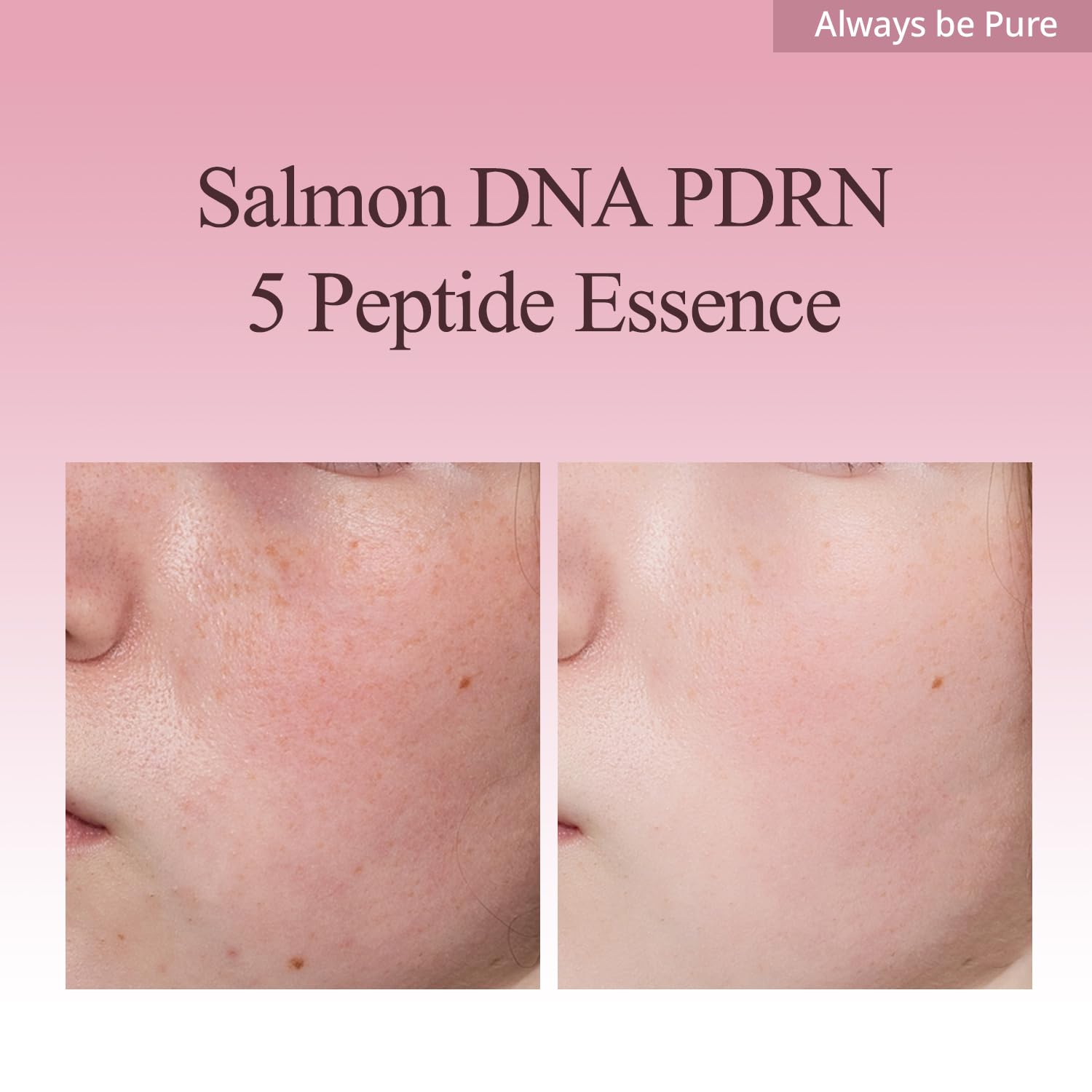 Always Be Pure Marine Origin Mela-PDRN Peptide Essence – Skin Renewal Serum with Salmon DNA & Niacinamide (150ml)