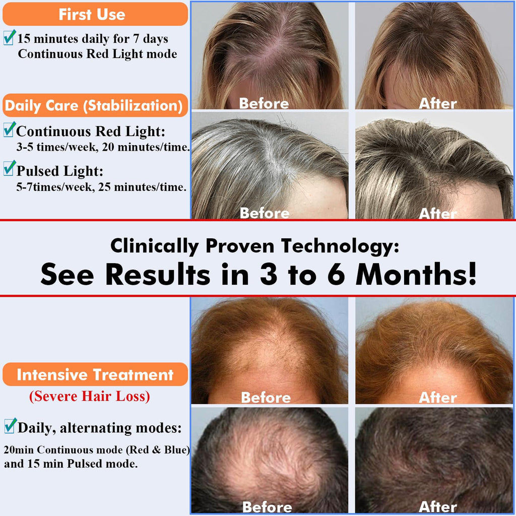 AmaBiuty Red Light Hair Growth Cap — 360° Red & Blue LED Therapy for Hair Regrowth