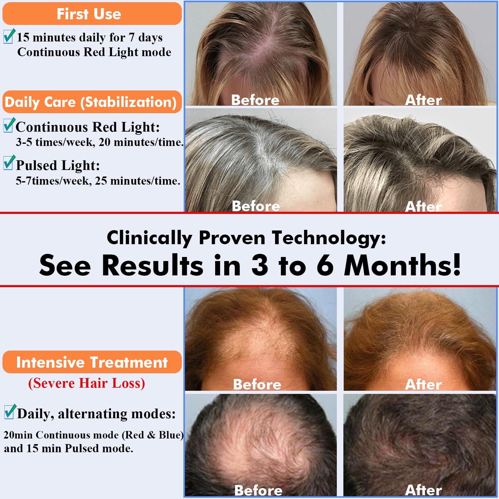 AmaBiuty Red Light Hair Growth Cap — 360° Red & Blue LED Therapy for Hair Regrowth