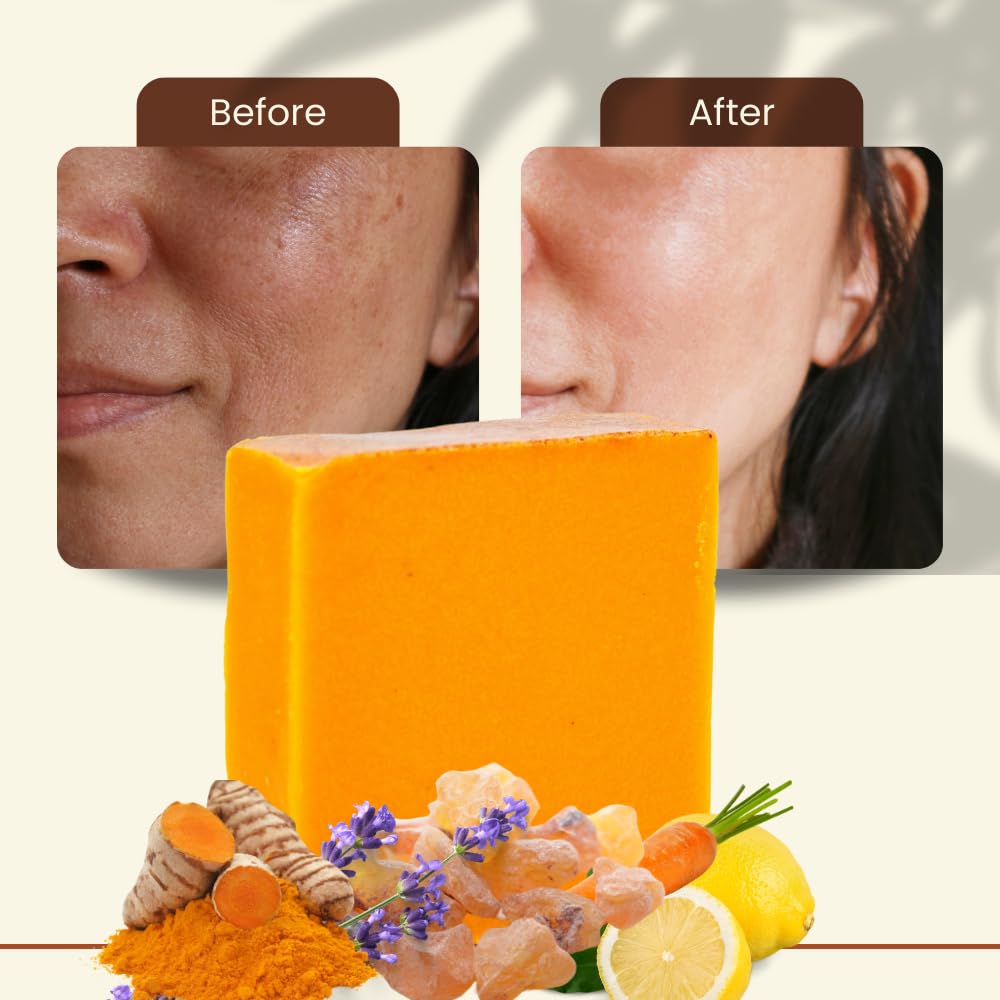 Turmeric Skin Cleansing Soap – Ammoya Naturals | Natural Glow Face & Body Cleanser (2 Bars, 4.5 oz)