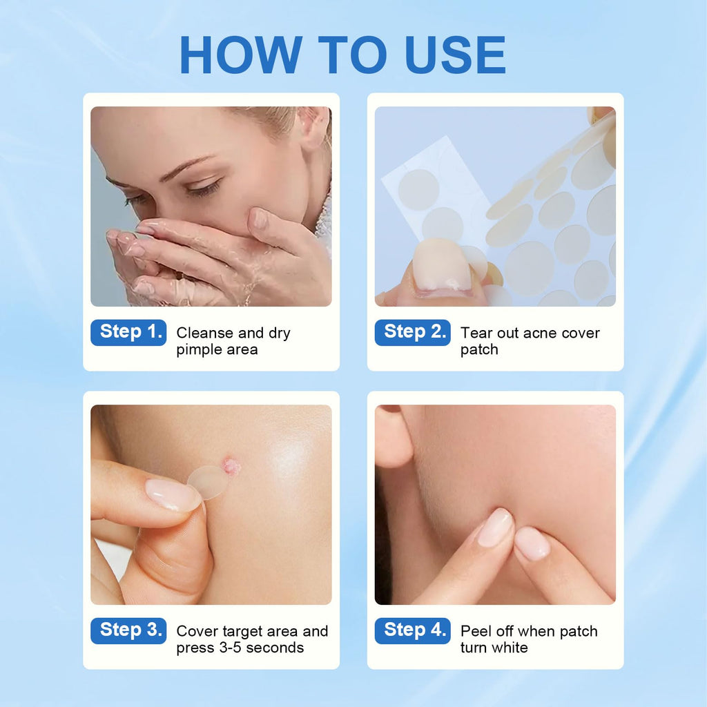 Amouy Acne Pimple Patch – 2 Sizes, 612 Dots Hydrocolloid Patches with Witch Hazel, Tea Tree & Calendula