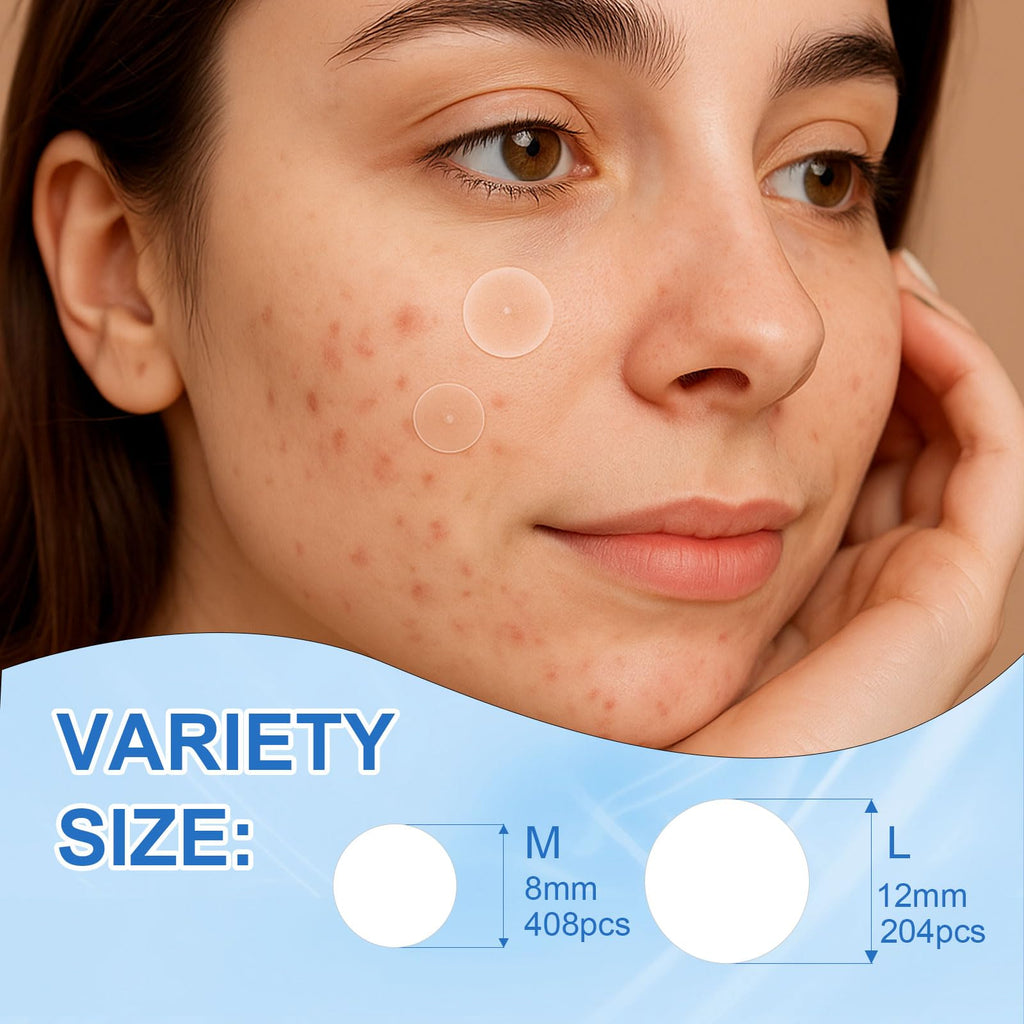 Amouy Acne Pimple Patch – 2 Sizes, 612 Dots Hydrocolloid Patches with Witch Hazel, Tea Tree & Calendula