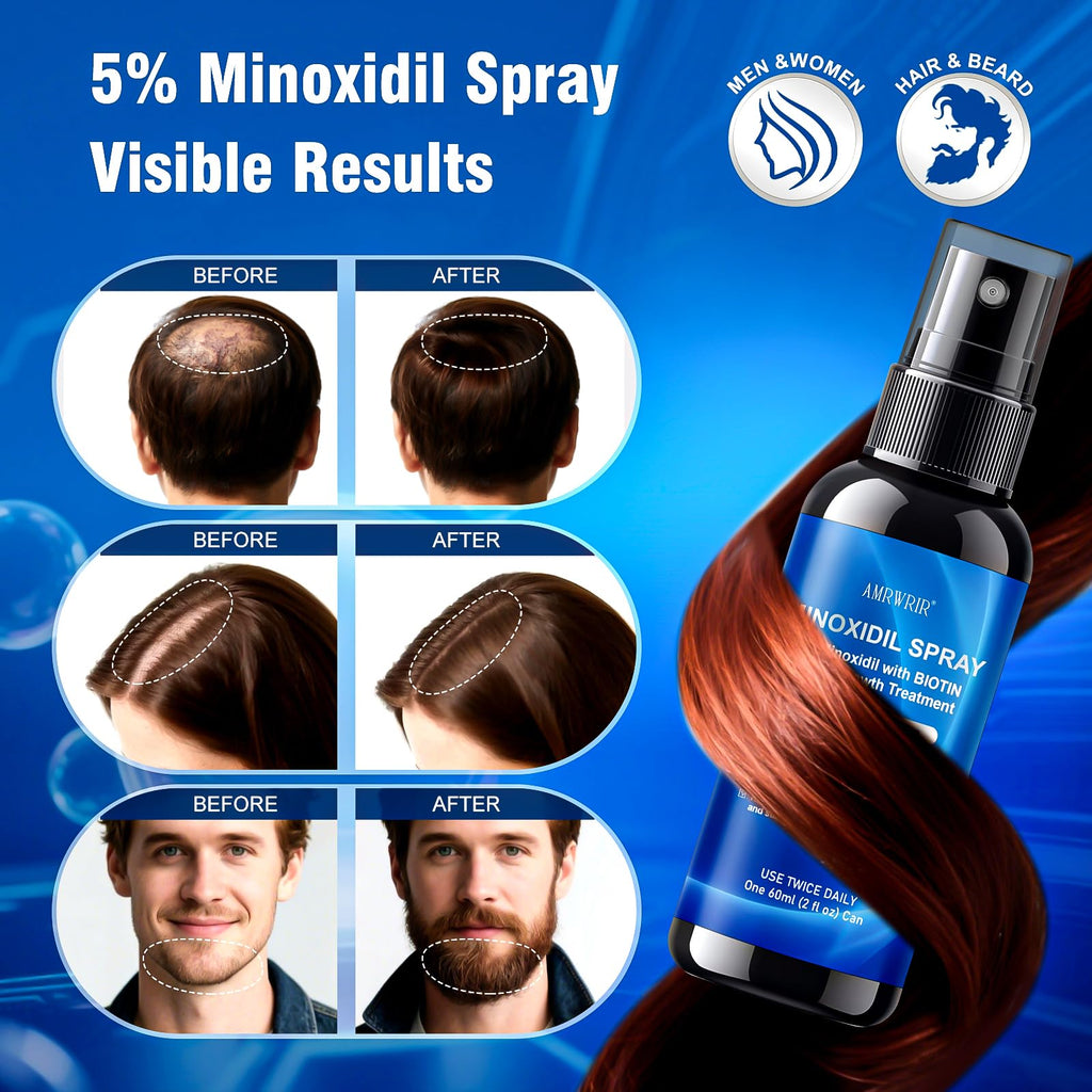 AMRWRIR 5% Minoxidil Spray for Hair Growth – Biotin & Castor Oil Infusion (6 Month Supply, 6 Pcs, 12 Fl Oz)