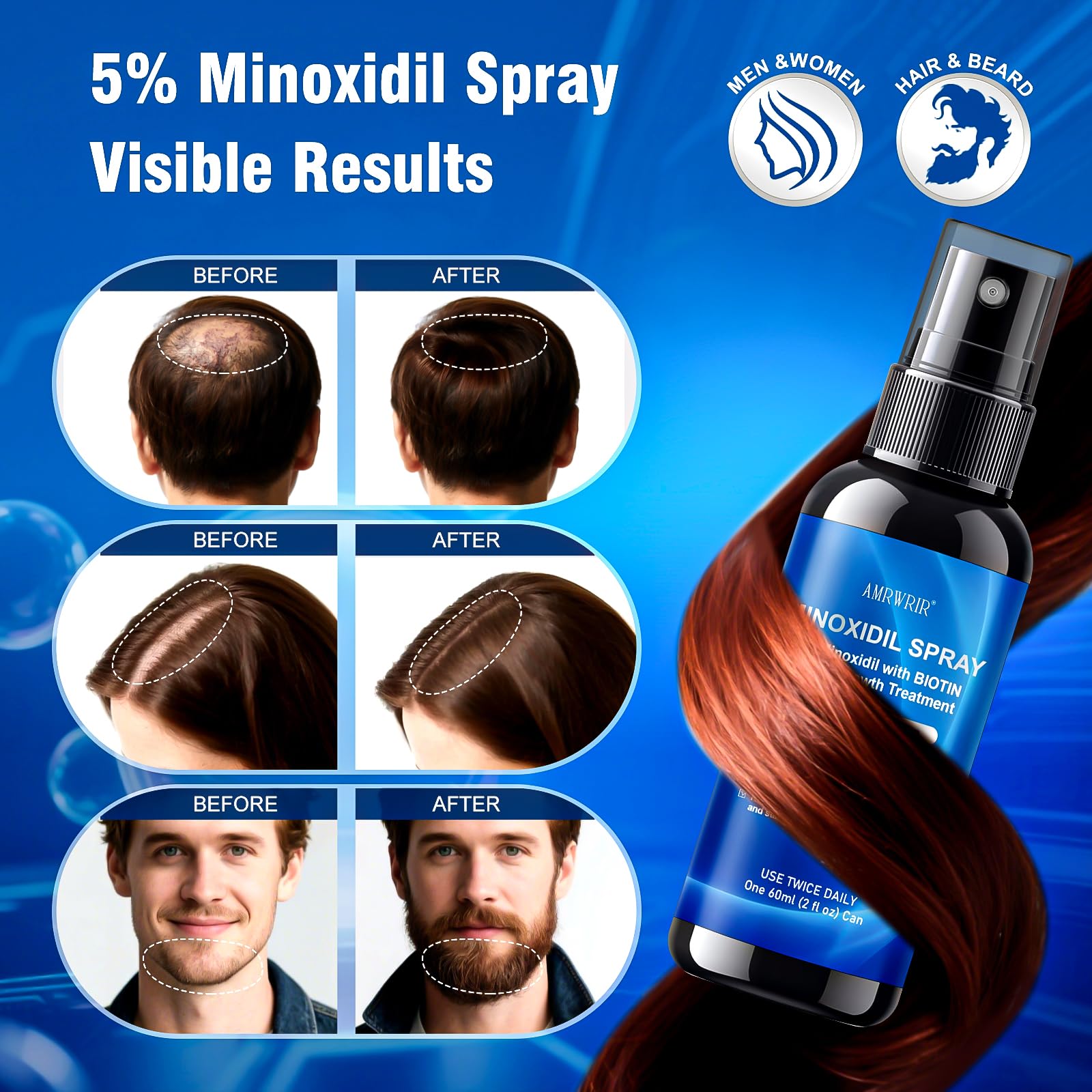 AMRWRIR 5% Minoxidil Spray for Hair Growth – Biotin & Castor Oil Infusion (6 Month Supply, 6 Pcs, 12 Fl Oz)