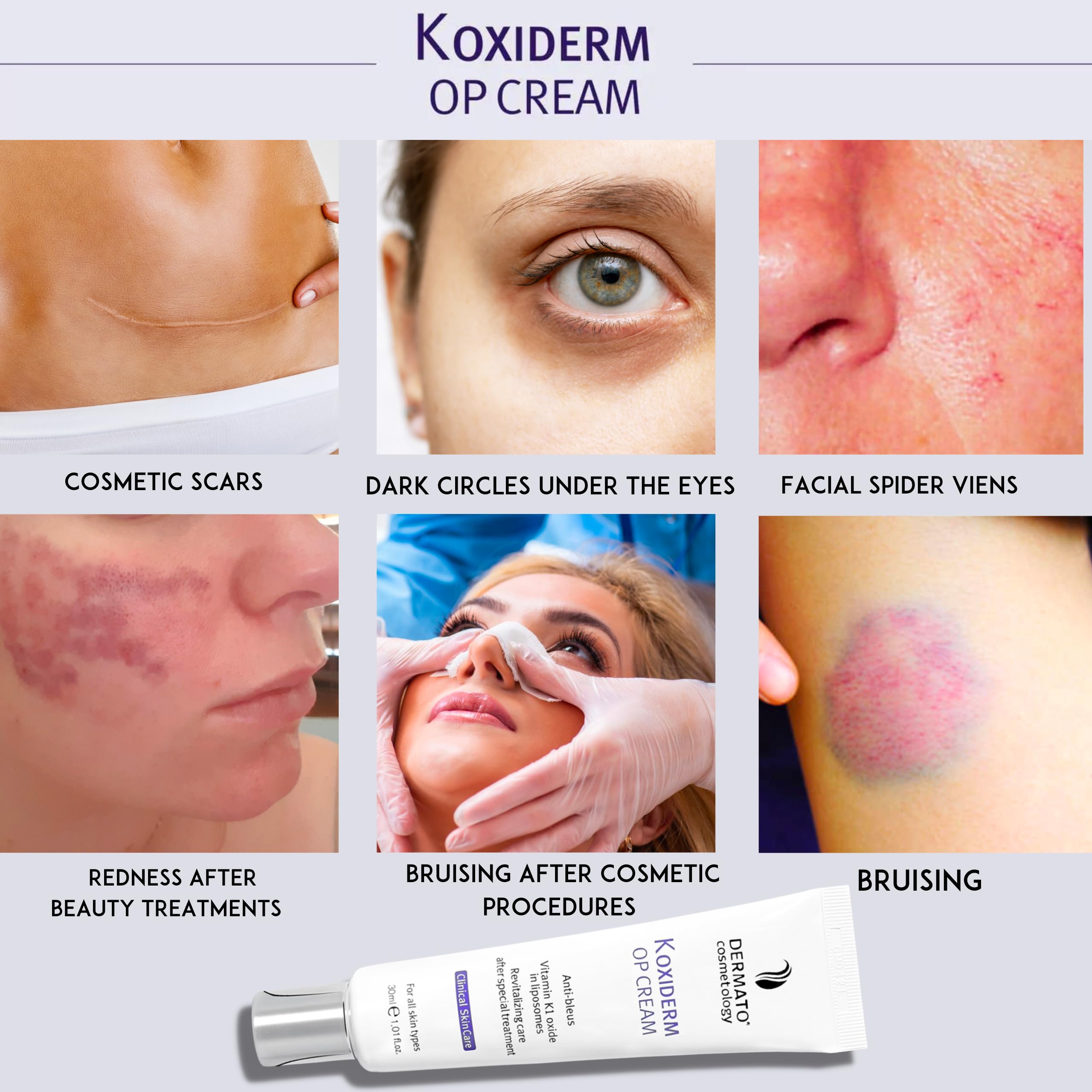 Anacis Vitamin K1 Oxiderm Cream – Minimize Scars, Dark Circles, Bruises | 1.01 oz