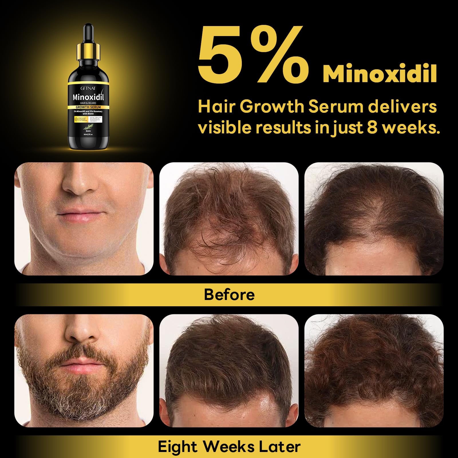 Andelusita 5% Minoxidil with Rosemary & Biotin – Hair & Beard Growth Serum