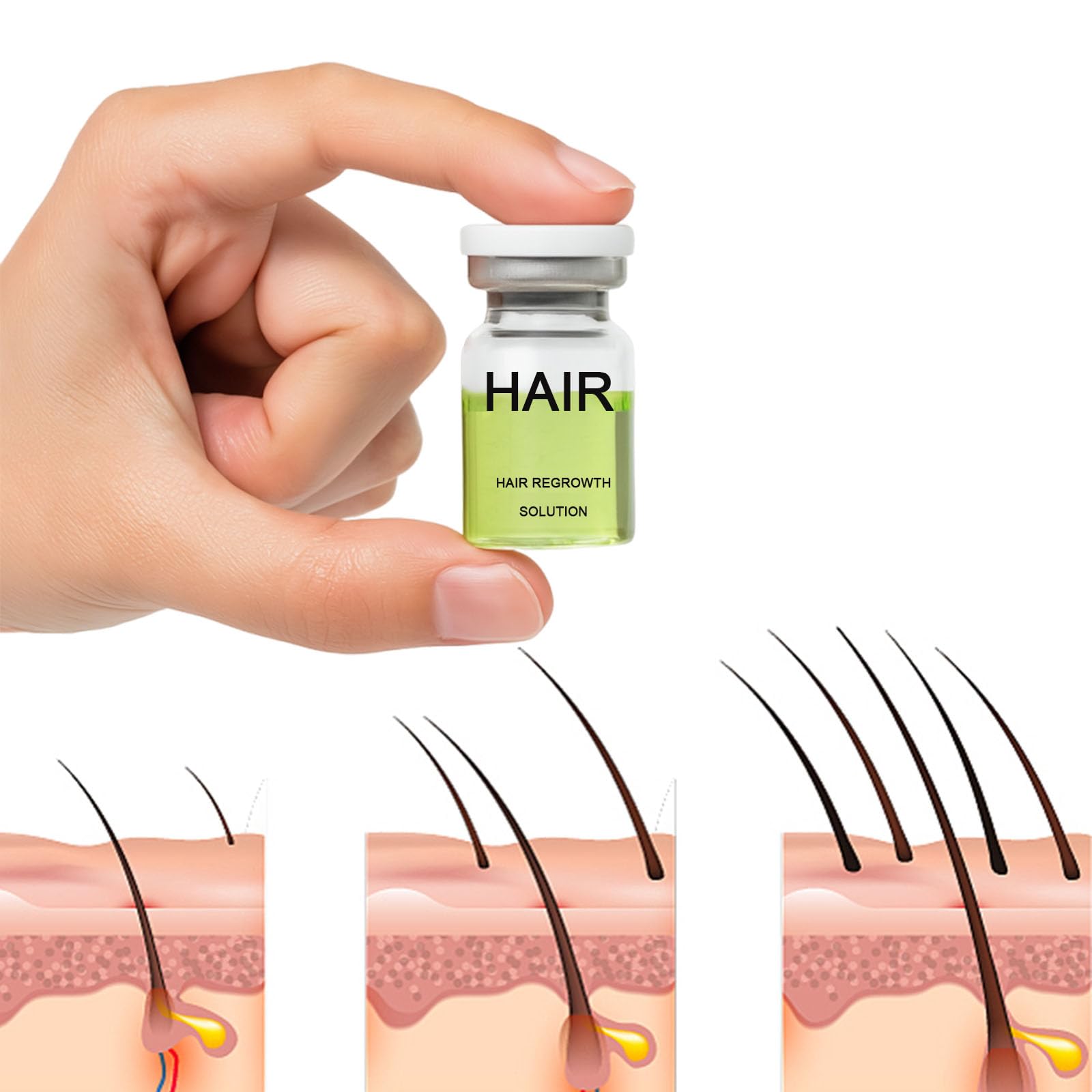 Hair Regrowth System | ANEFOSE — Ginseng, Eclipta Prostrata, Peppermint Oil & Ginger Root for Thicker Hair
