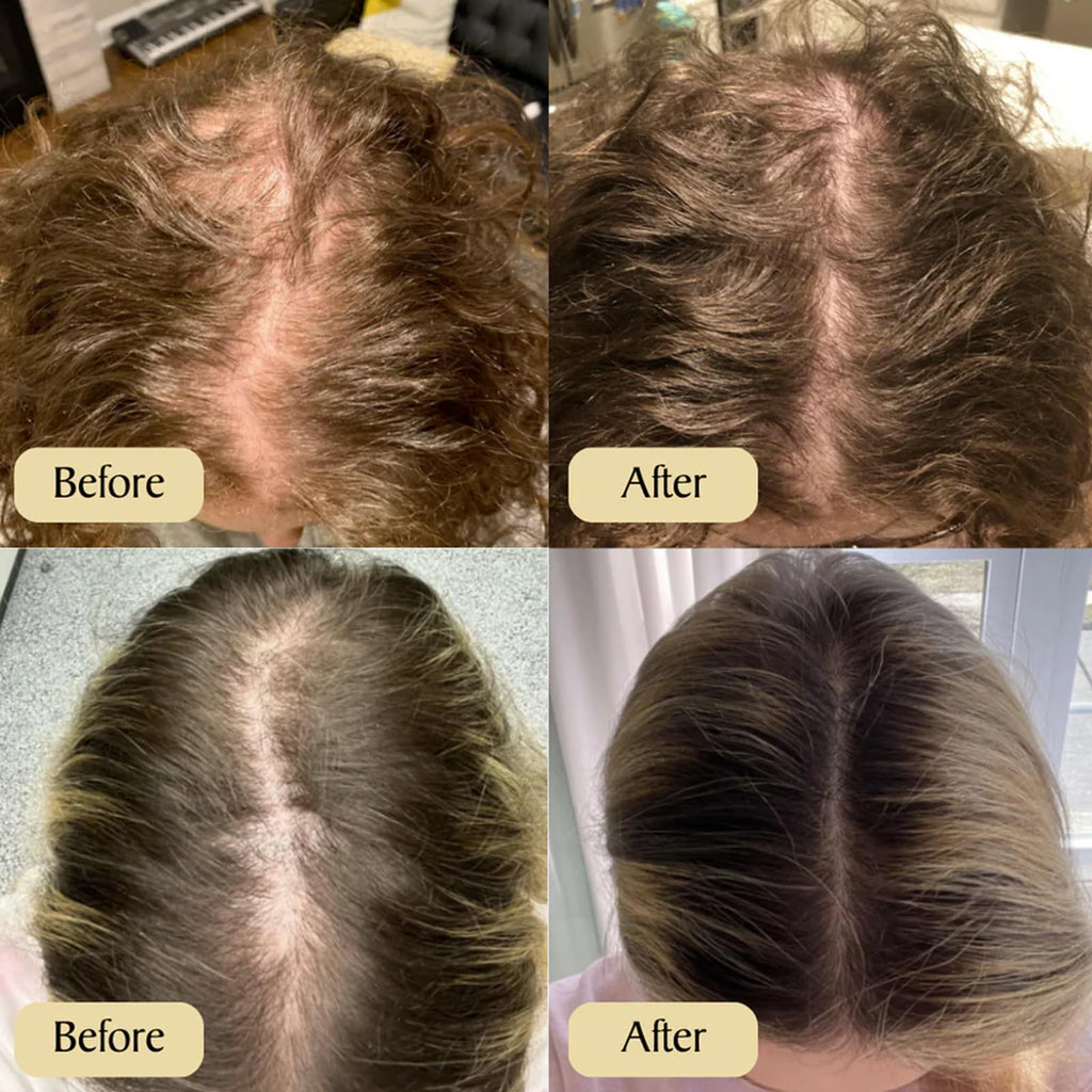 Animus Batana Oil – 100% Pure Batana Paste Hair Mask for All Hair Types