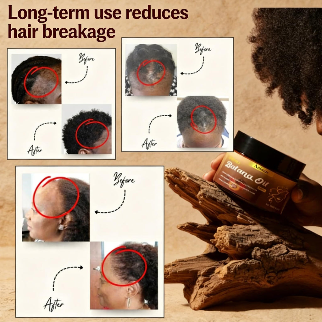 Animus Batana Oil – 100% Pure Batana Paste Hair Mask for All Hair Types