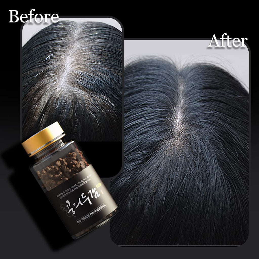 Antique Alive ROOTONIX Korean Hair Growth Supplement – Hasuo Black Bean Pellet Complex for Thicker, Fuller Hair