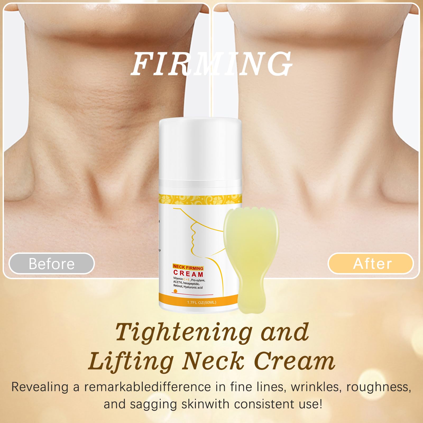 ANTIVP Neck Cream for Tightening & Firming - Gua Sha Kit with Collagen, Retinol & Hyaluronic Acid