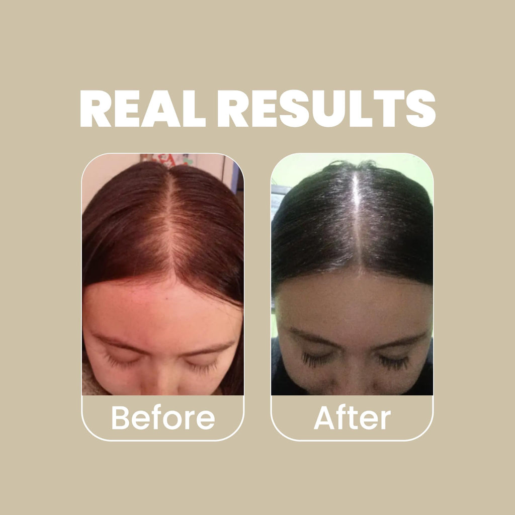 ANYELUZ Rosemary Shampoo & Conditioner Set with Hyaluronic Acid – Strengthen, Hydrate, Shine