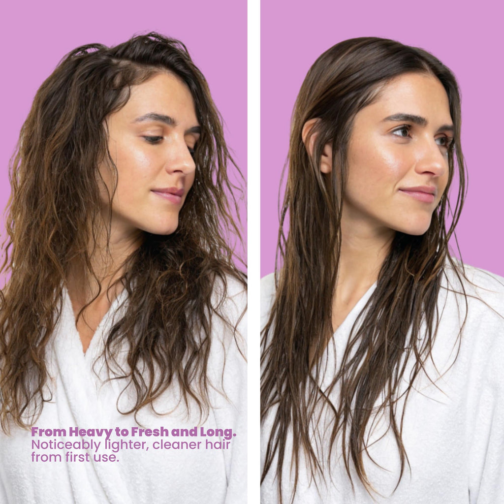 ANYELUZ Onion Hair Care Set — Shampoo, Conditioner & Hair Mask