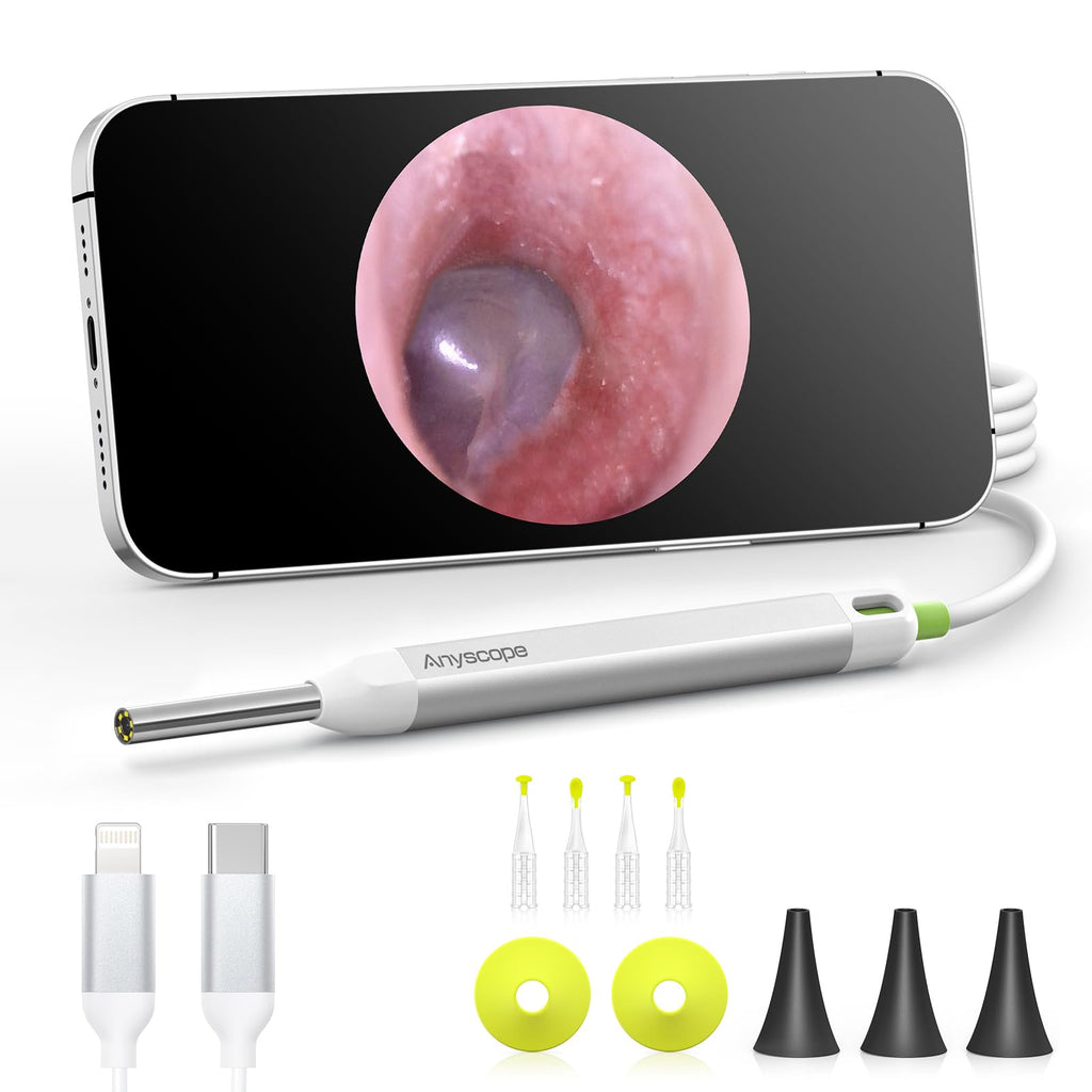 AnyScope HD Digital Otoscope — Ear Camera with Light, iPhone & Android Compatible (Silver)
