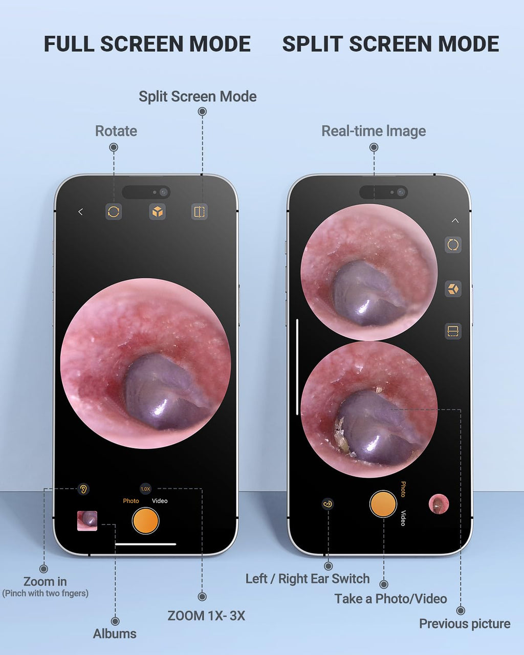AnyScope HD Digital Otoscope — Ear Camera with Light, iPhone & Android Compatible (Silver)
