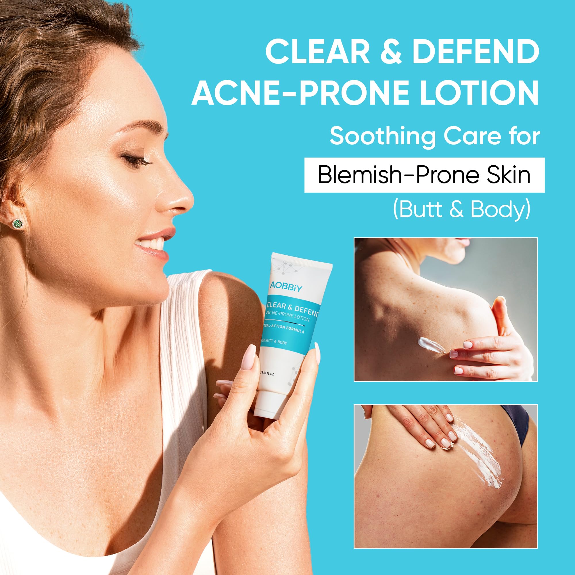 AOBBIY Butt Acne Clearing Treatment Cream — 2% Salicylic Acid & Niacinamide for Back, Butt & Body