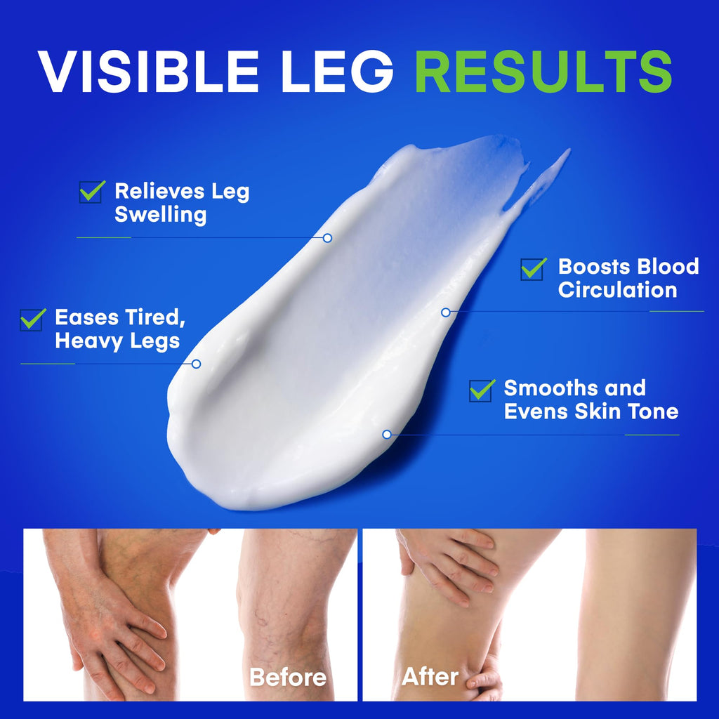 AOSORW Varicose & Spider Veins Cream – Natural Leg Vein Support, 3.4 Fl Oz