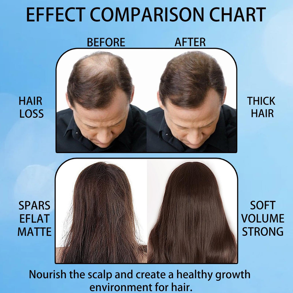 Aparthy Hair Growth Roll-On – Rosemary Serum for Thicker, Stronger Hair (3pcs)