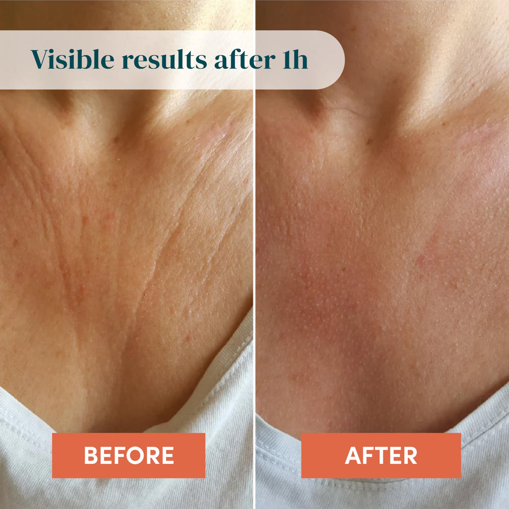APRICOT Liberté Décolleté Silicone Chest Patch with Hyaluronic Acid | 30x Reusable | Made in Germany
