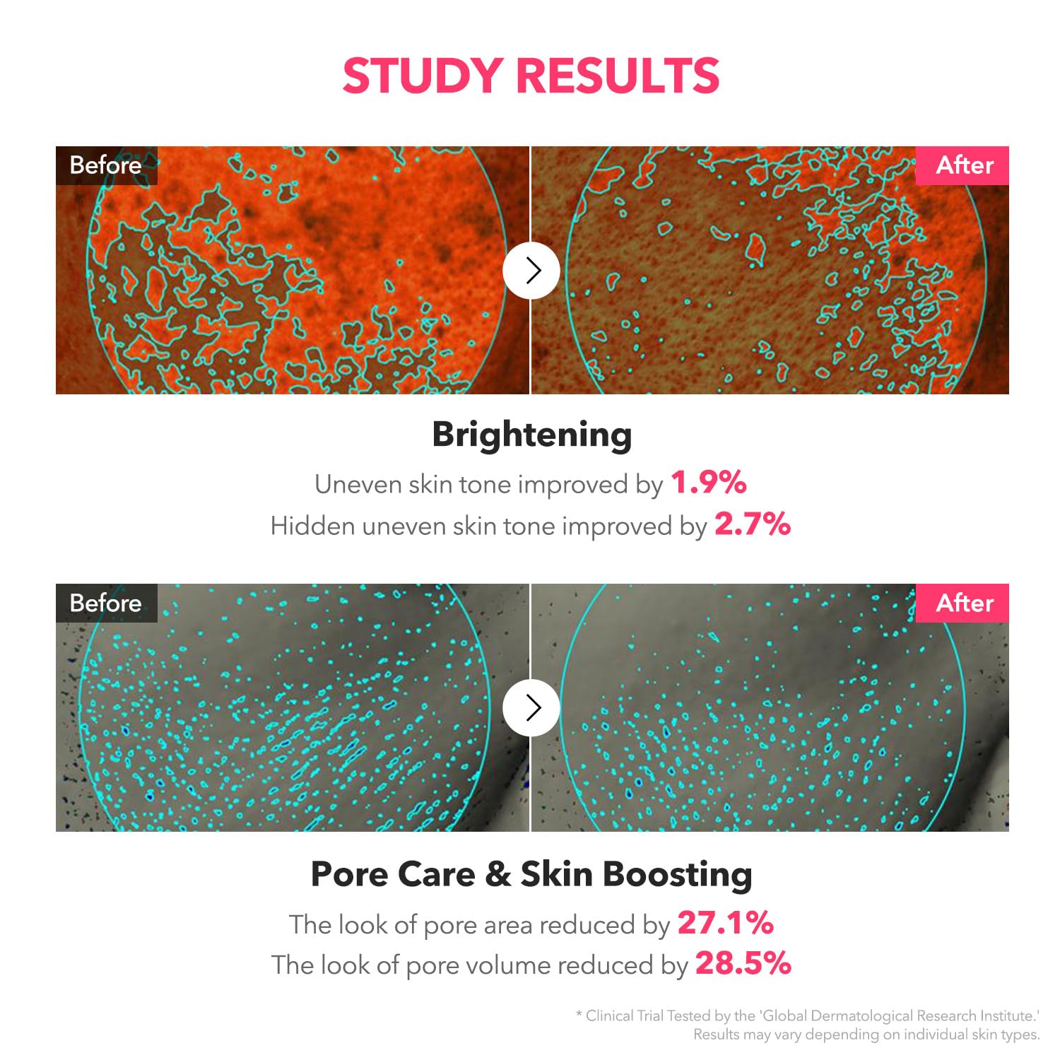 APRILSKIN TXA Niacinamide Toning Shot – 99% TXA + Niacinamide 5% | Skin Booster Serum