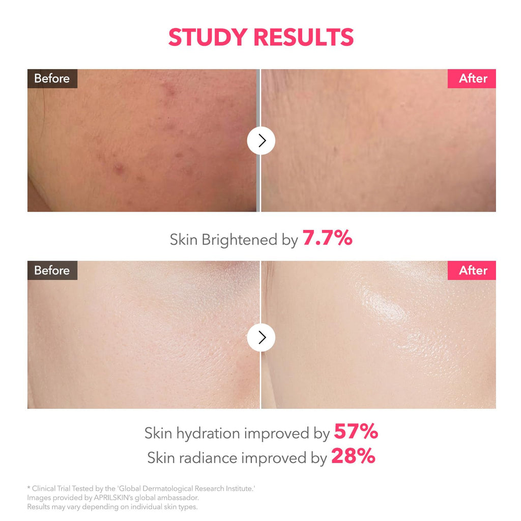 APRILSKIN TXA Pink Capsule Gel Mask | Overnight Glow with 99% TXA for Uneven Tone, Hydration & Radiance