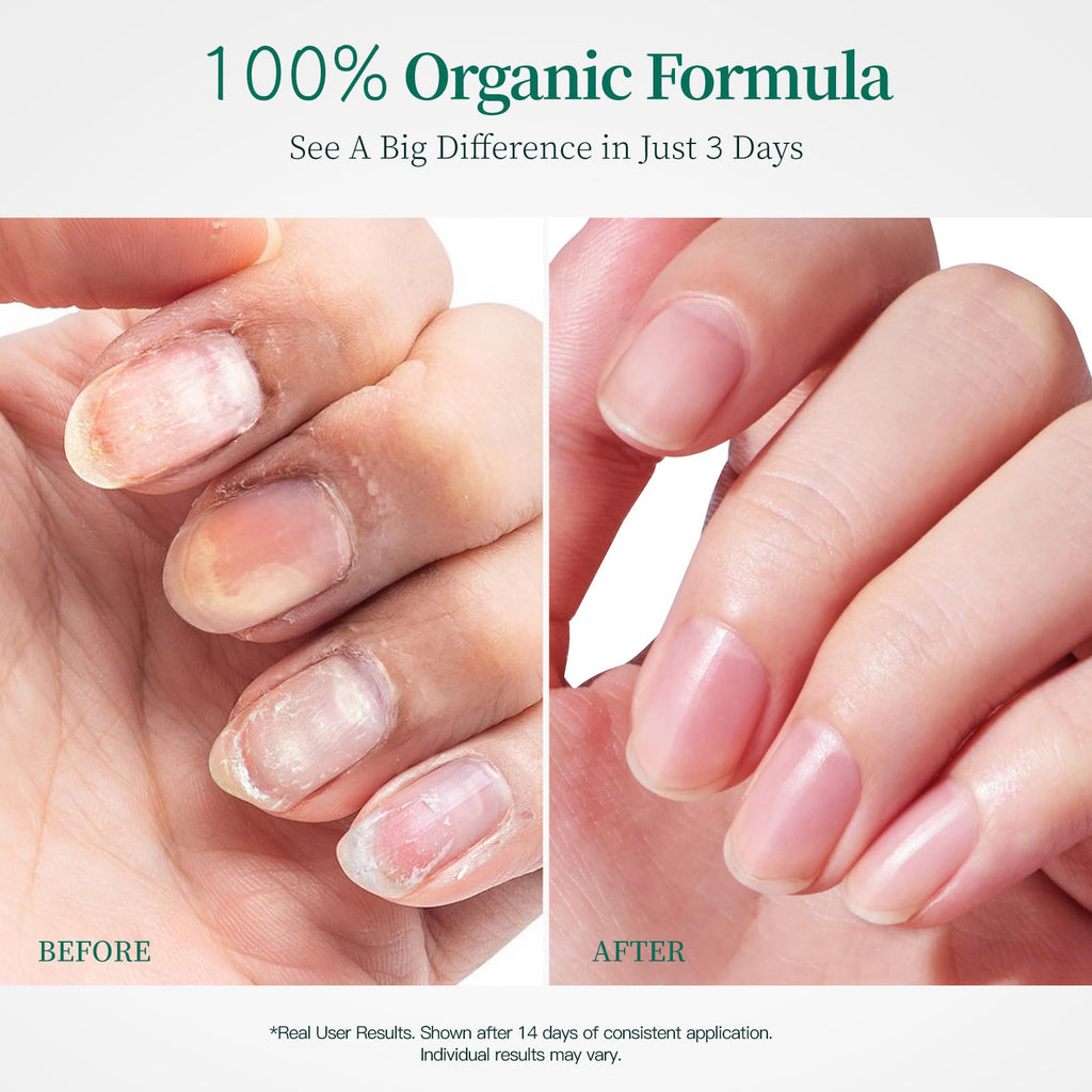 APUREE 100% Bio-Based Cuticle Oil — Nail Strengthener & Growth Oil, 1oz | USDA Verified, Vegan