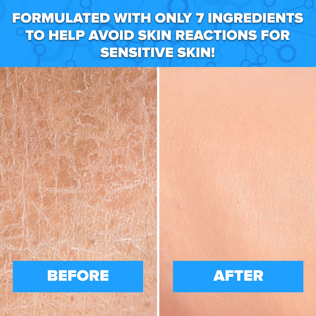 Aquanil Lipid-Free Cleanser for Sensitive Skin | Fragrance-Free, Soap-Free, 3 Pack – 16 oz
