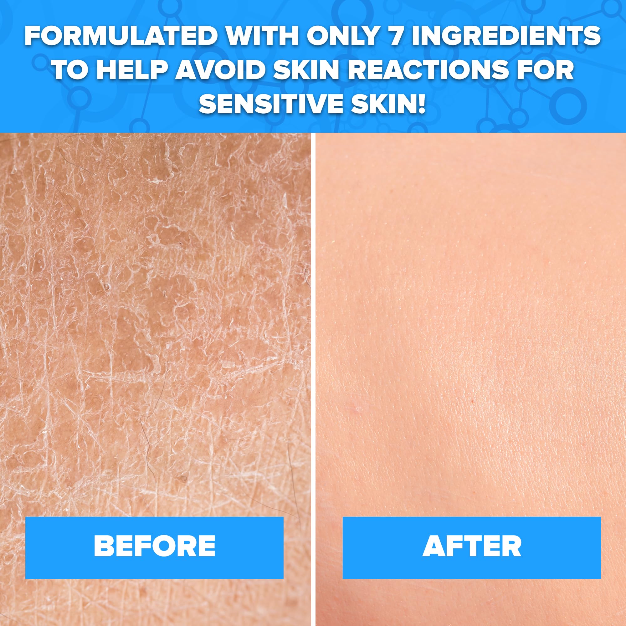Aquanil Lipid-Free Cleanser for Sensitive Skin | Fragrance-Free, Soap-Free, 3 Pack – 16 oz