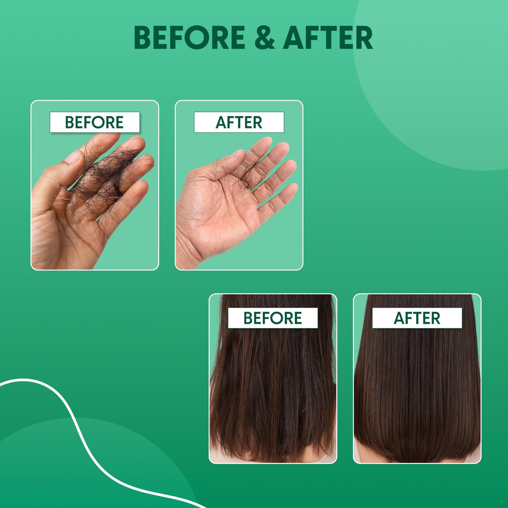 Aravi Organic Rosemary Anti Hairfall & Hair Growth Shampoo & Conditioner Combo | Sulphate-Free | For Dry & Frizzy Hair | 200ml Each