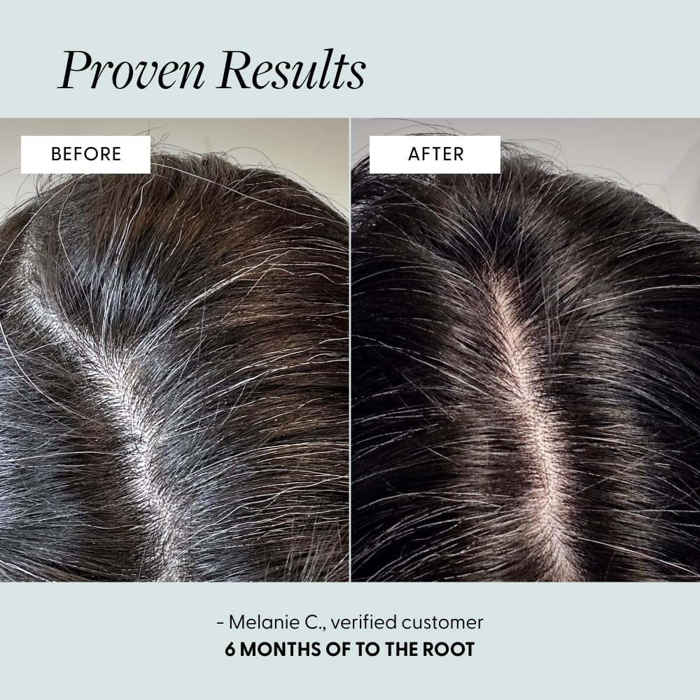 Arey To The Root Hair Serum | Slow Grey Hair & Pigment Preservation (3–6 Months) | Vegan, Oil-Free