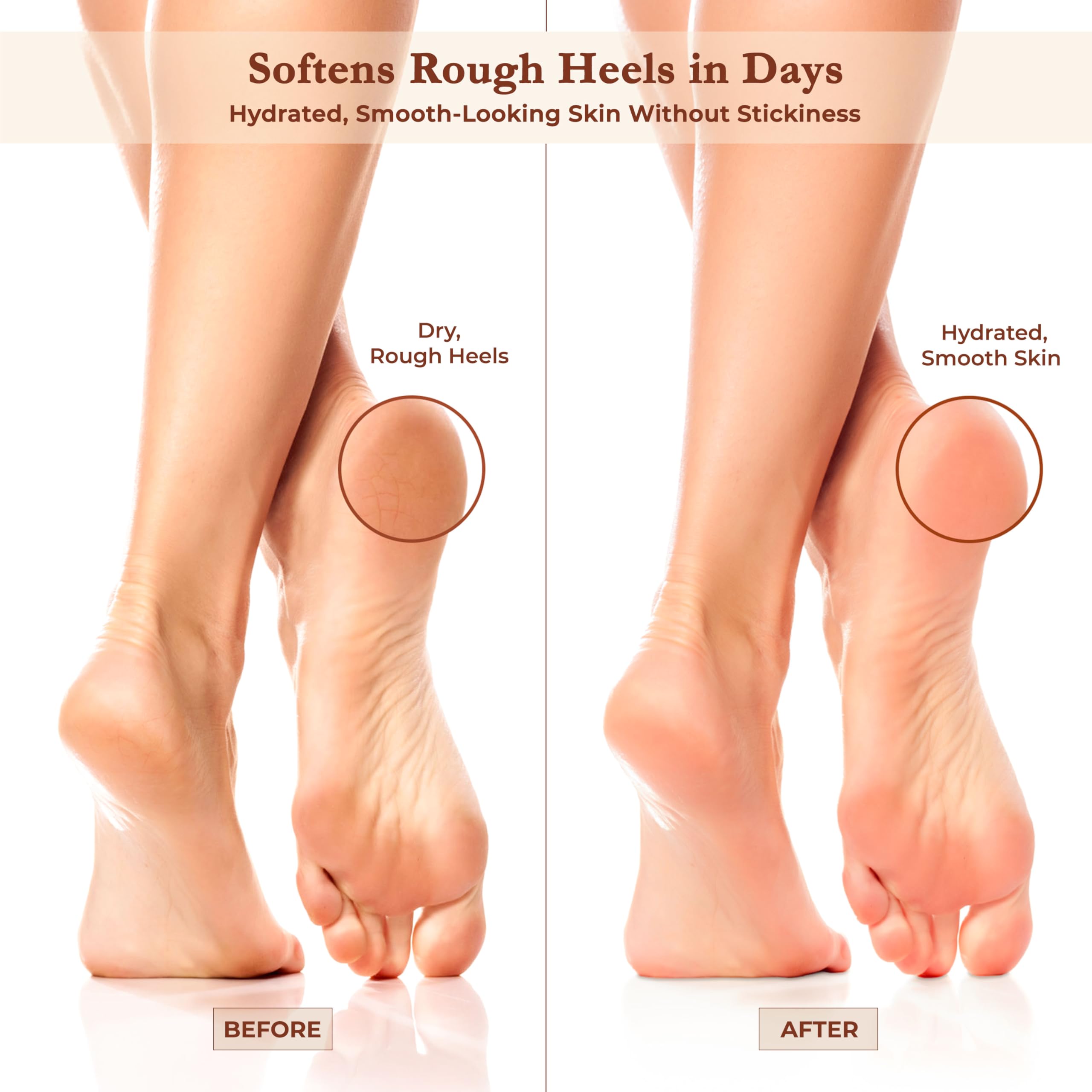 Argaviva Foot Cream for Dry Cracked Heels – Hydrating Moisturizer with Argan Oil, Shea Butter & Vitamin E