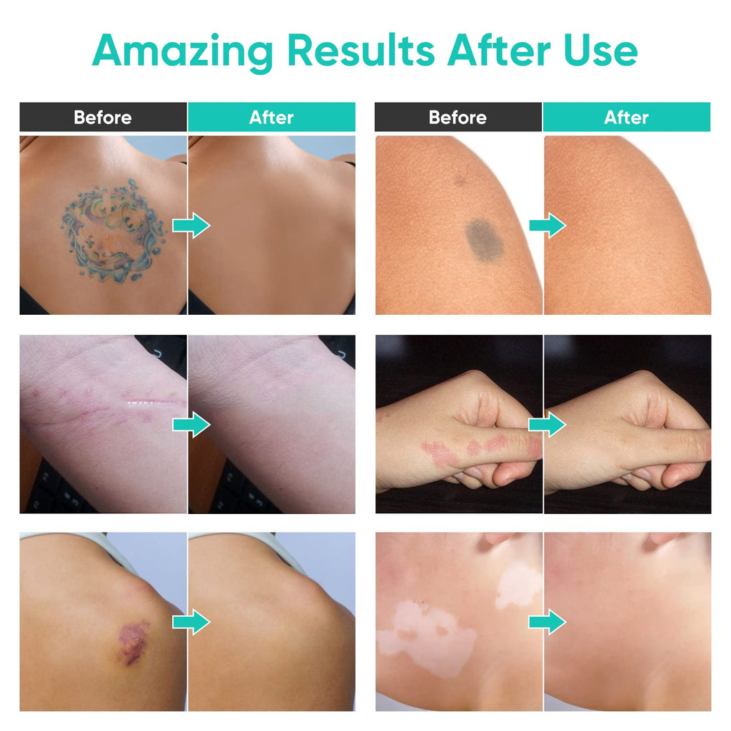 ARIOS Tattoo Cover Up Makeup Waterproof – 2-Color Long Lasting Body Concealer for Tattoos, Scars, Vitiligo & Dark Spots
