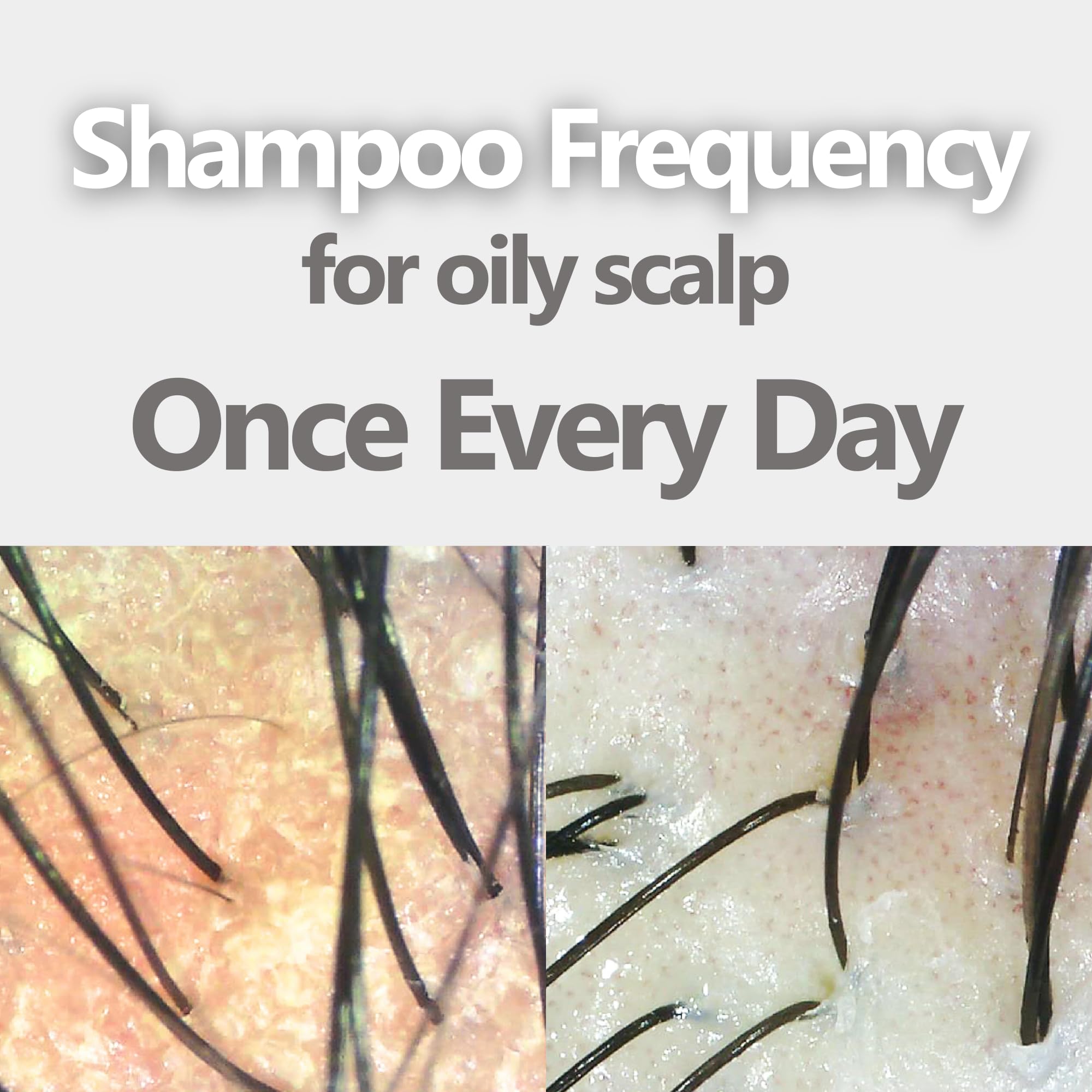 AROMASE Oily Scalp Balancing Shampoo – Gentle pH 5.5, 14 oz
