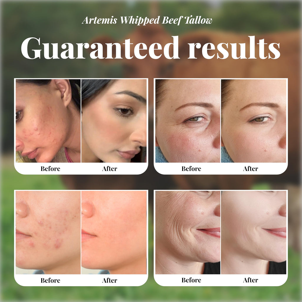 Artemis Beef Tallow Balm – Grass-Fed, All-Natural Moisturizer for Face & Body (6 oz)