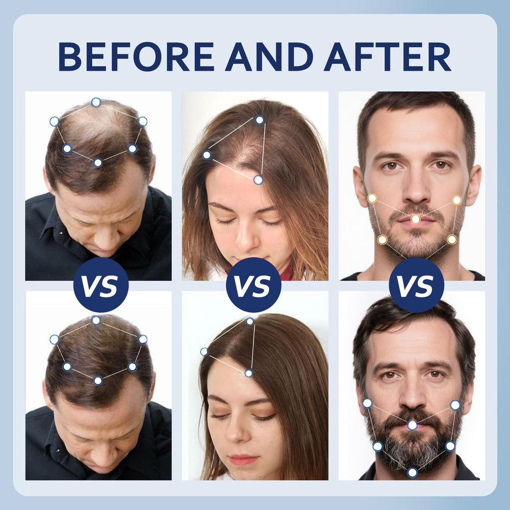 Artimore 5% Minoxidil Hair Growth Serum for Men & Women with Biotin — Extra Strength Topical Solution, 6 oz x 3 Pack