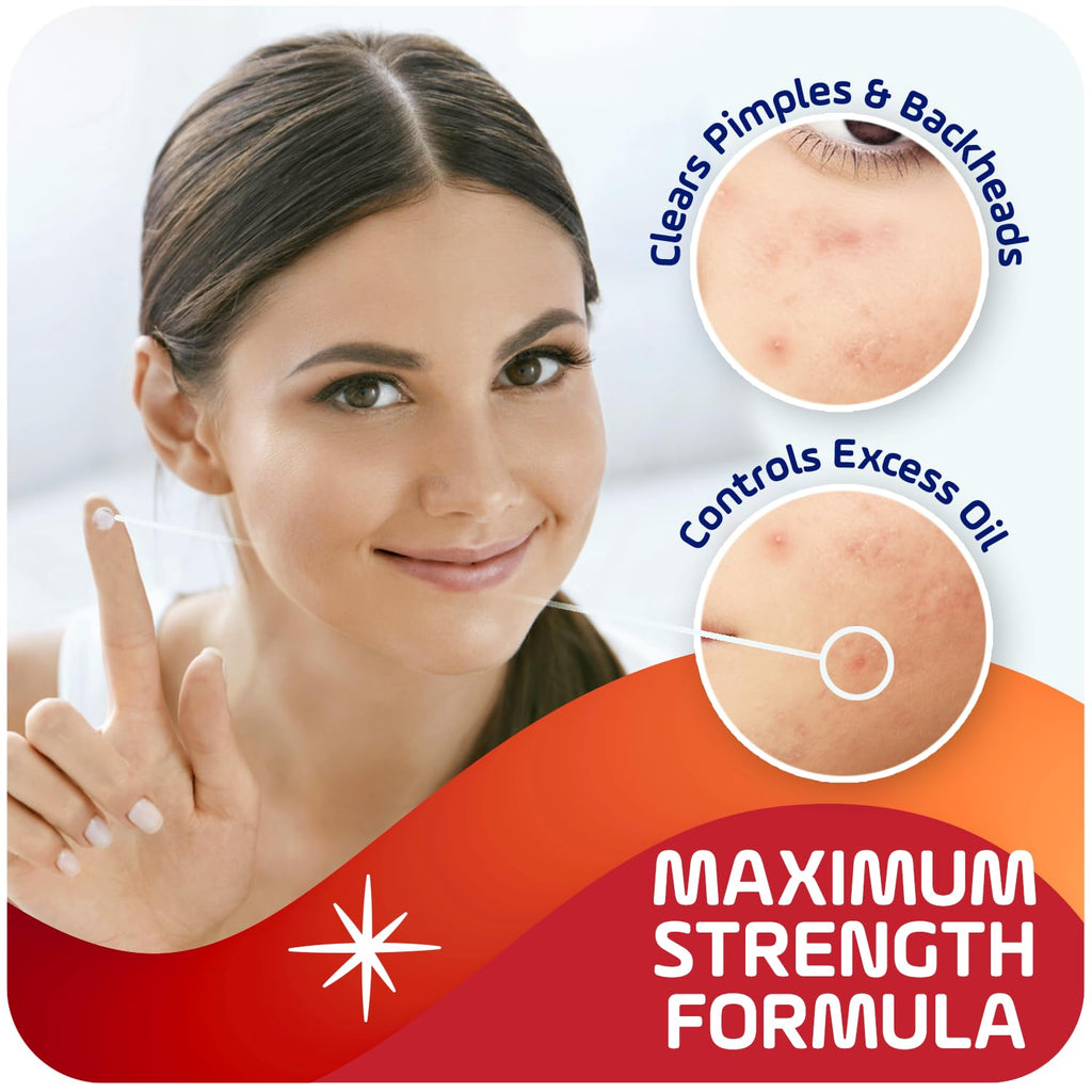 Asepxia 2% Salicylic Acid Acne Spot Treatment Cream | Drying Formula for Clearer Skin, 1 oz, 1-Pack