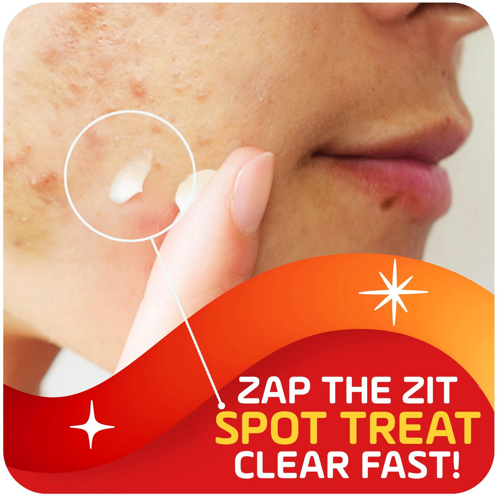 Asepxia 2% Salicylic Acid Acne Spot Treatment Cream | Drying Formula for Clearer Skin, 1 oz, 1-Pack