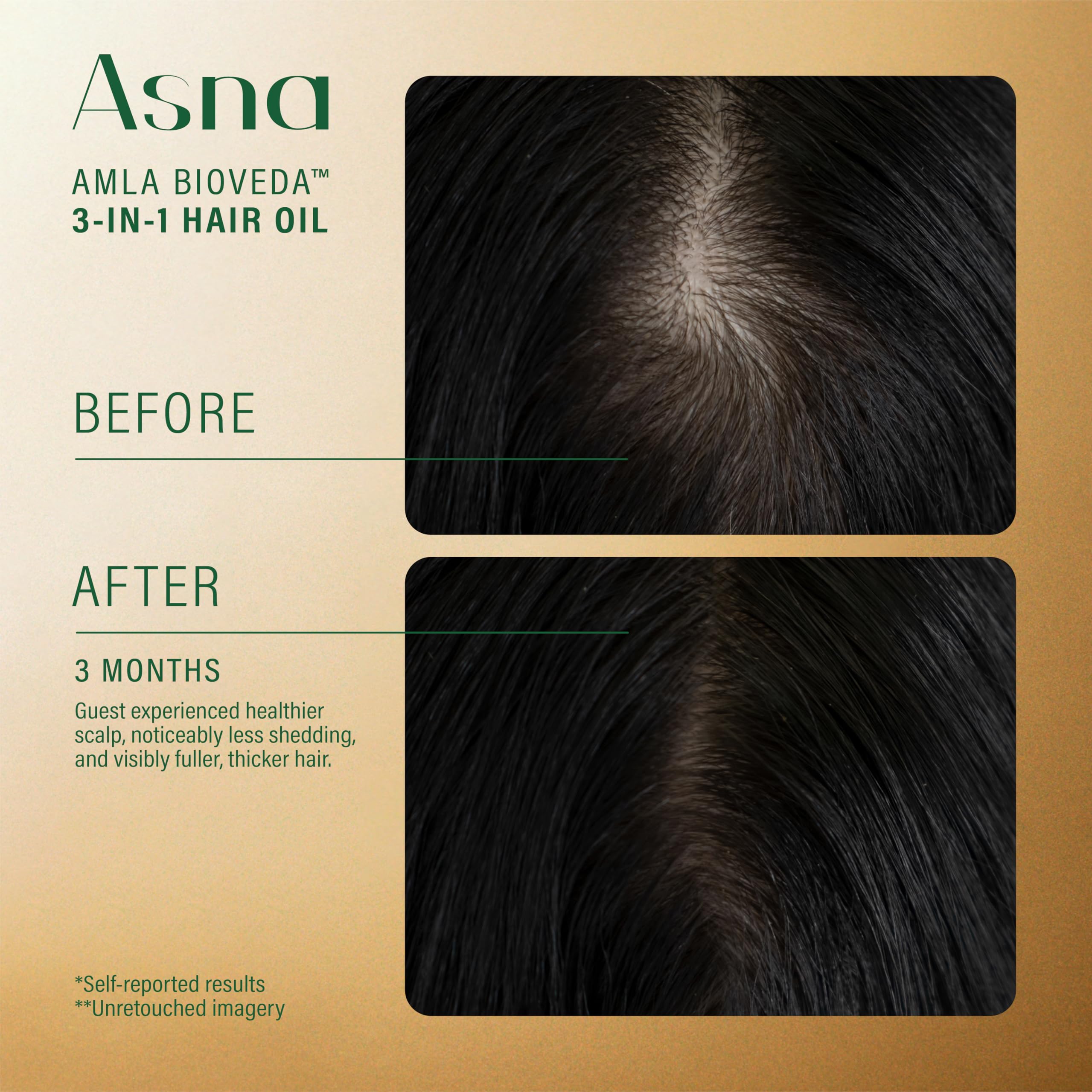 Asna Amla BioVeda 3-in-1 Hair Oil – Organic Scalp Hydration, Frizz Control & Growth