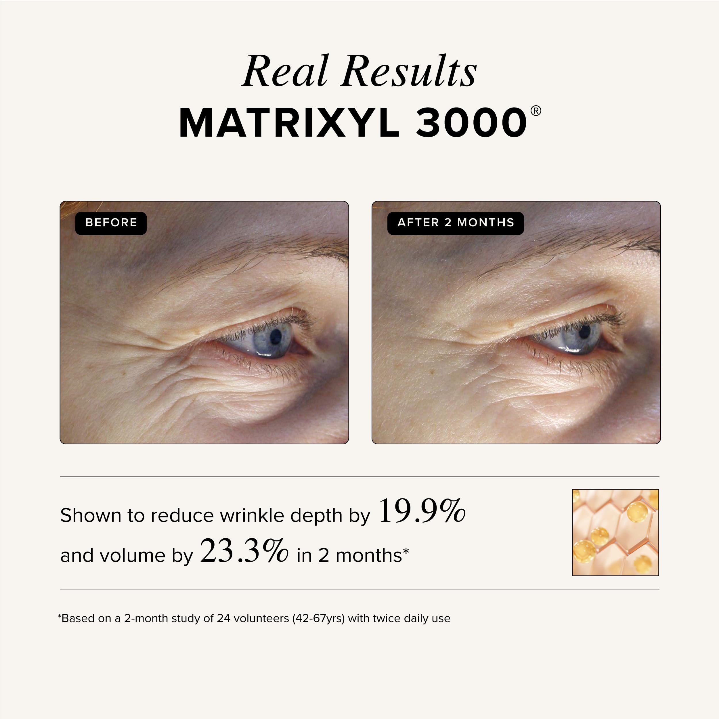 Asterwood Triple Repair Serum – Matrixyl 3000 + Argireline + Hyaluronic Acid + Vitamin C (Fragrance-Free) – 8 Fl Oz