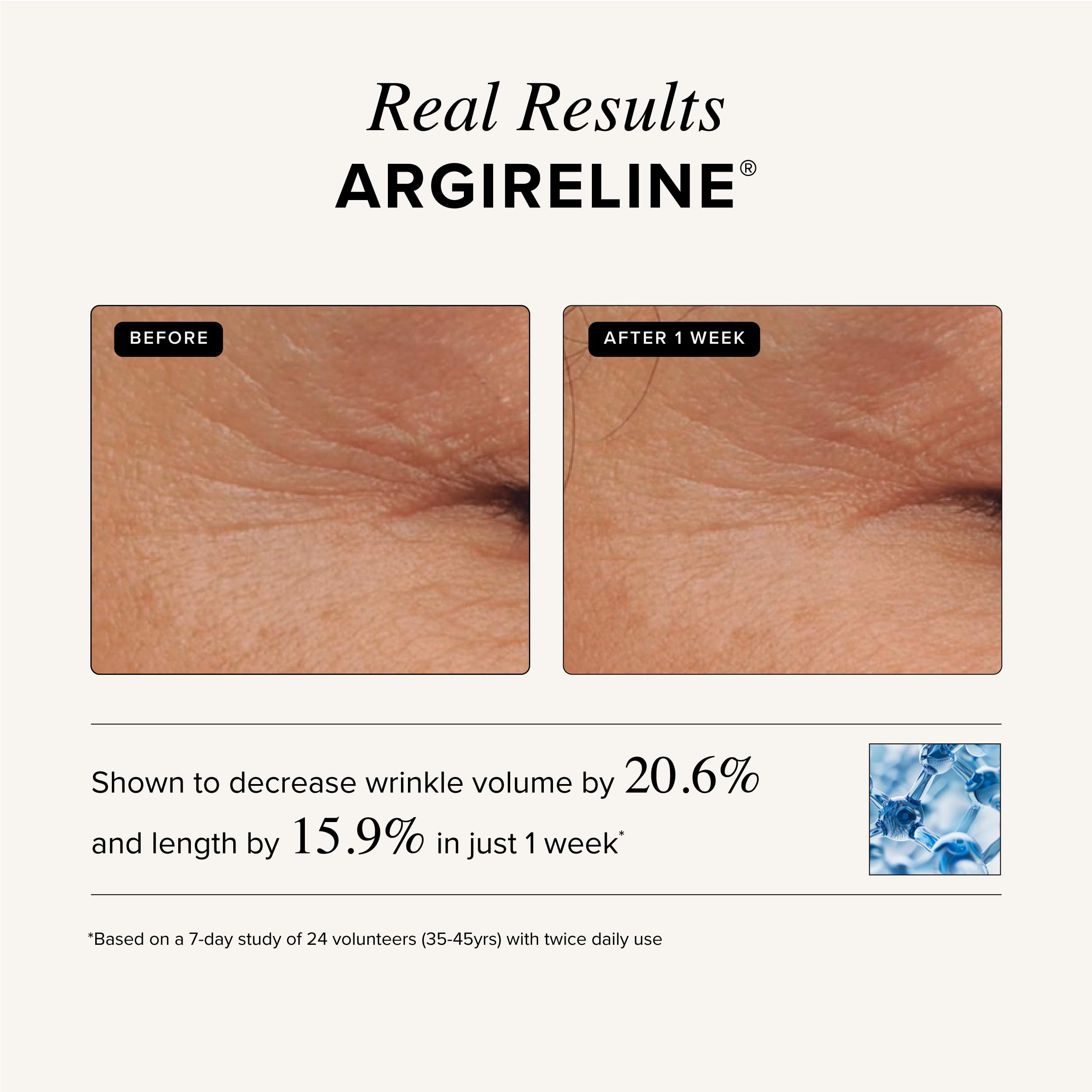 Asterwood Triple Repair Serum – Matrixyl 3000 + Argireline + Vitamin C + Hyaluronic Acid | Fragrance-Free, 2 oz