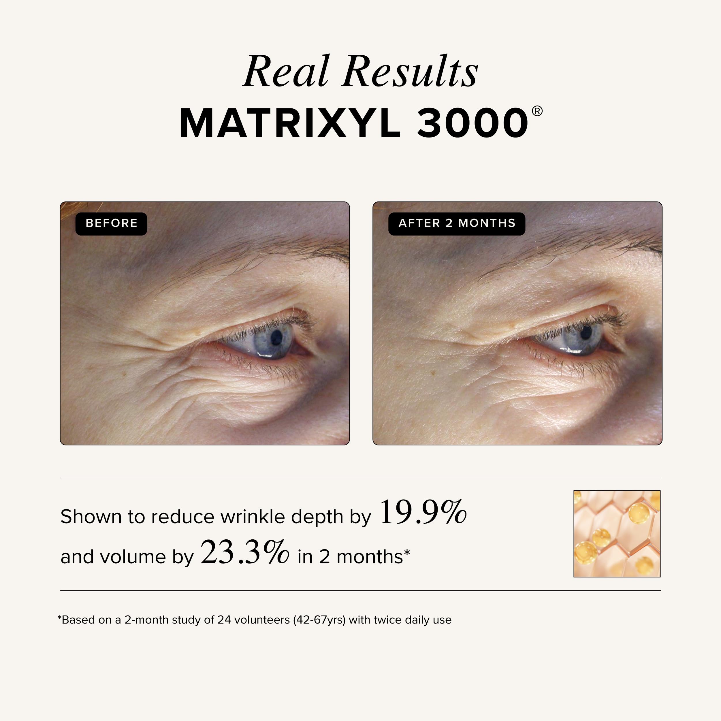Asterwood Matrixyl 3000 + Argireline + Vitamin C Cream – Fragrance-Free Triple Repair with Hyaluronic Acid (1.7 Fl Oz)