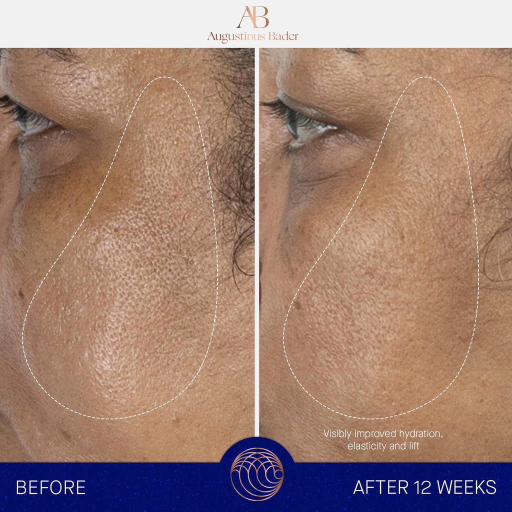 Augustinus Bader The Serum – Hydrating Anti-Aging Serum for Firmer, Smoother Skin (15 ml)