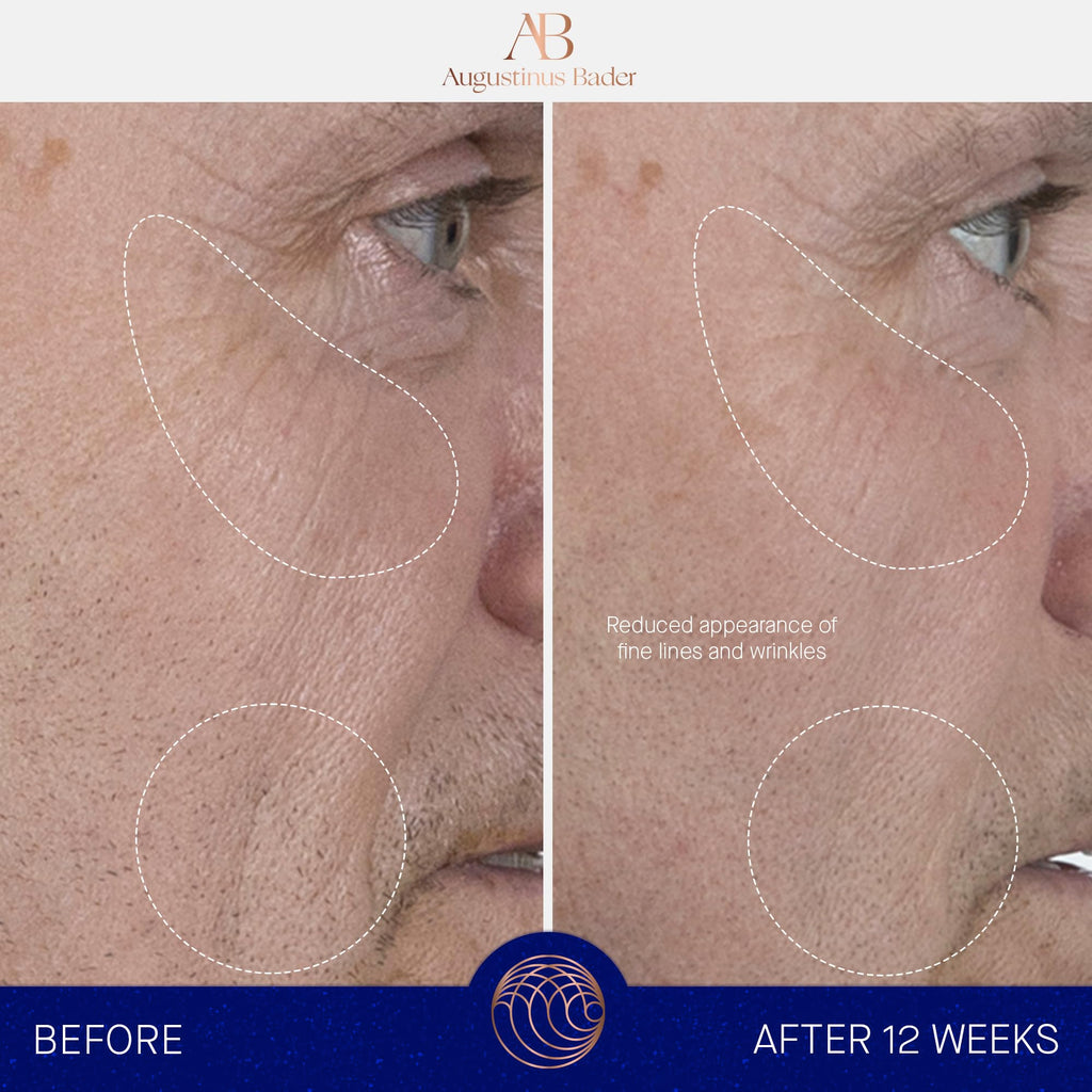 Augustinus Bader The Serum – Luxury Hydrating Anti‑Aging Serum